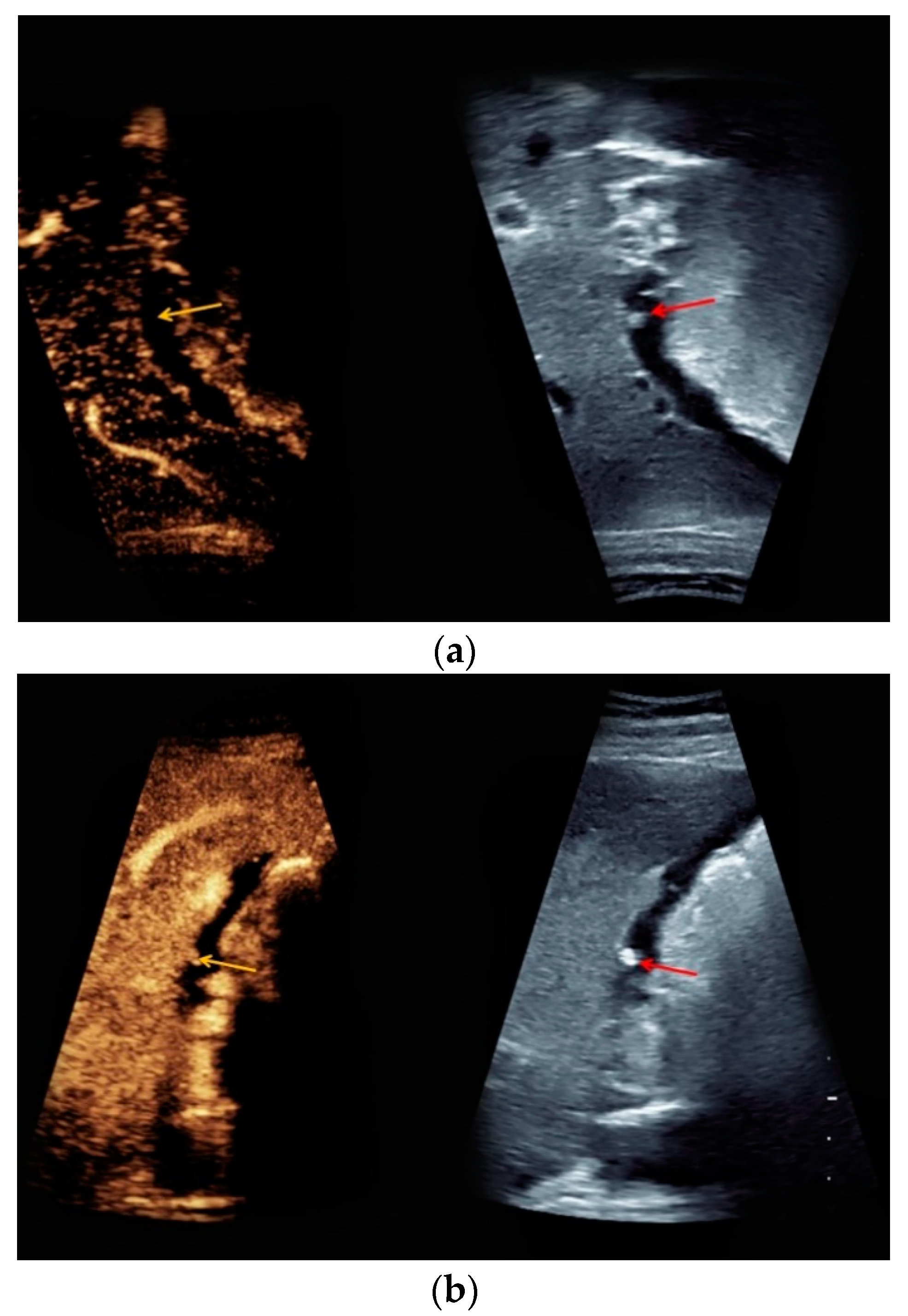 Medicina 56 00675 g003 Medicina 56 00675 g003