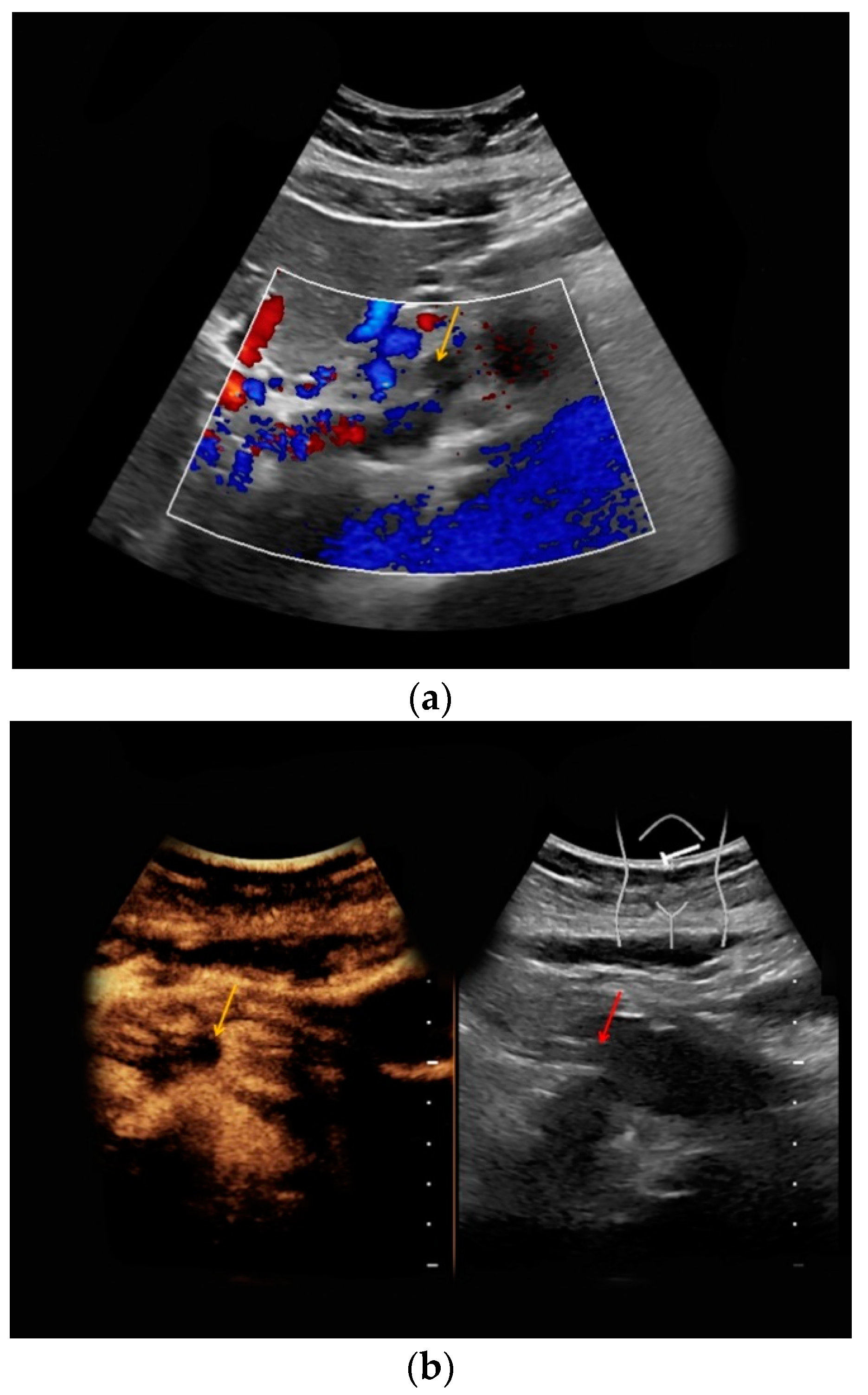 Medicina 56 00675 g004 Medicina 56 00675 g004