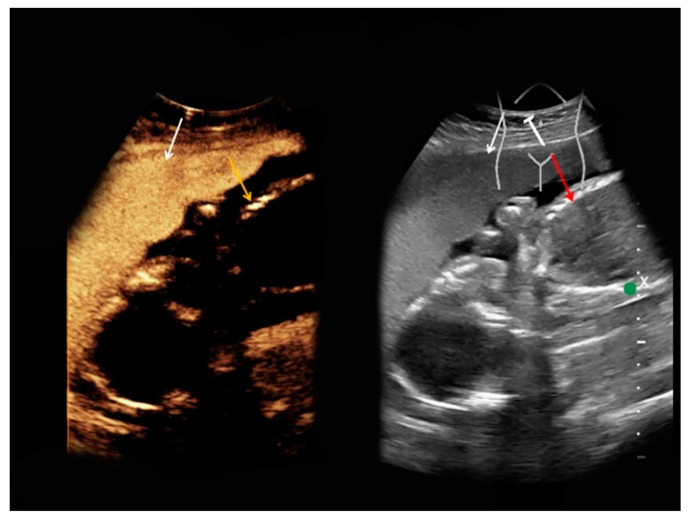 Medicina 56 00675 g005 Medicina 56 00675 g005