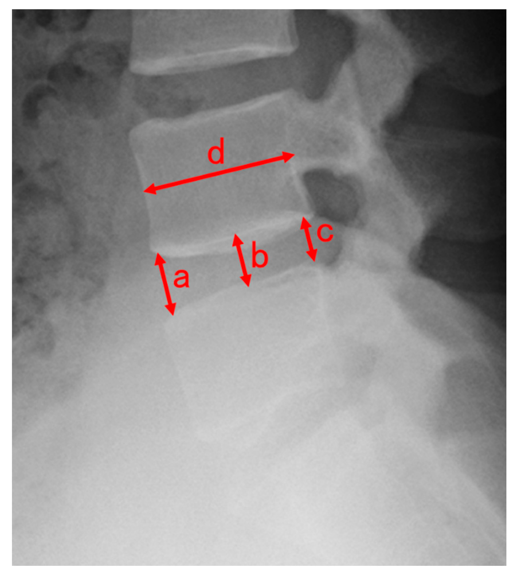 Medicina 56 00710 g002 Medicina 56 00710 g002