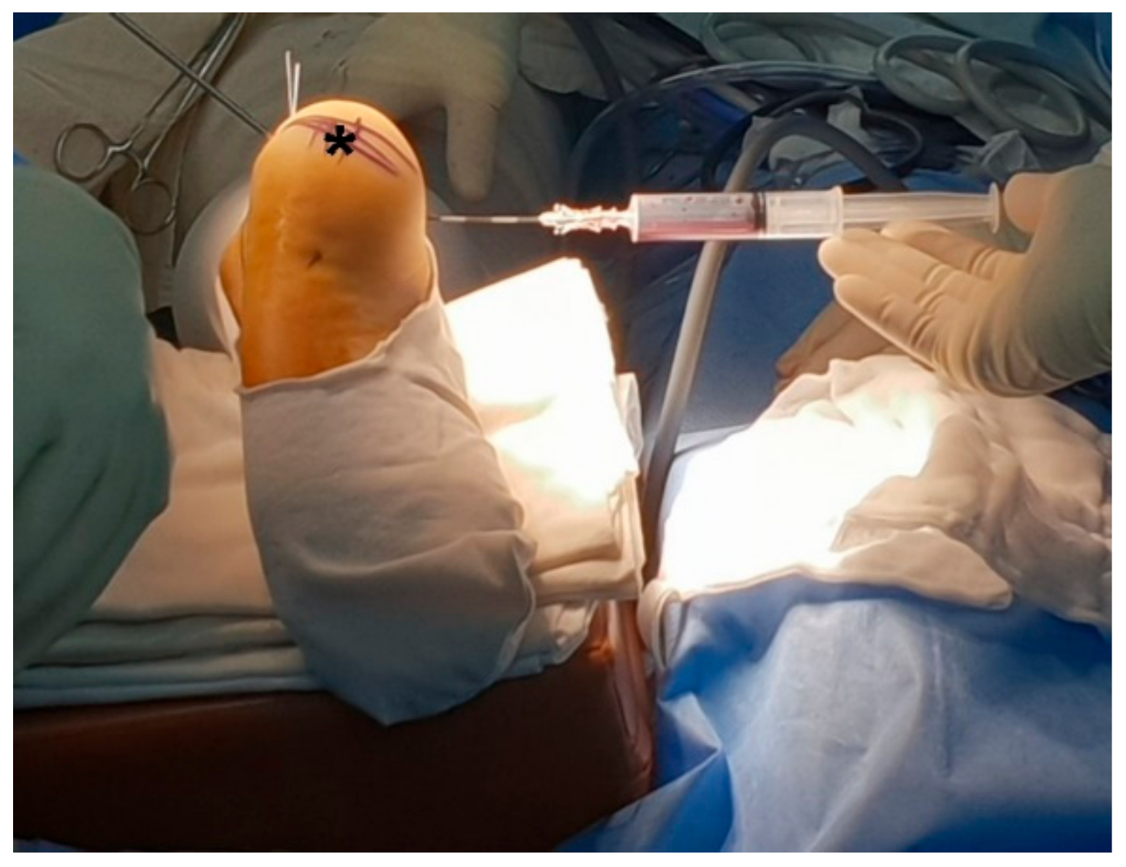 Medicina 57 00111 g004 Medicina 57 00111 g004