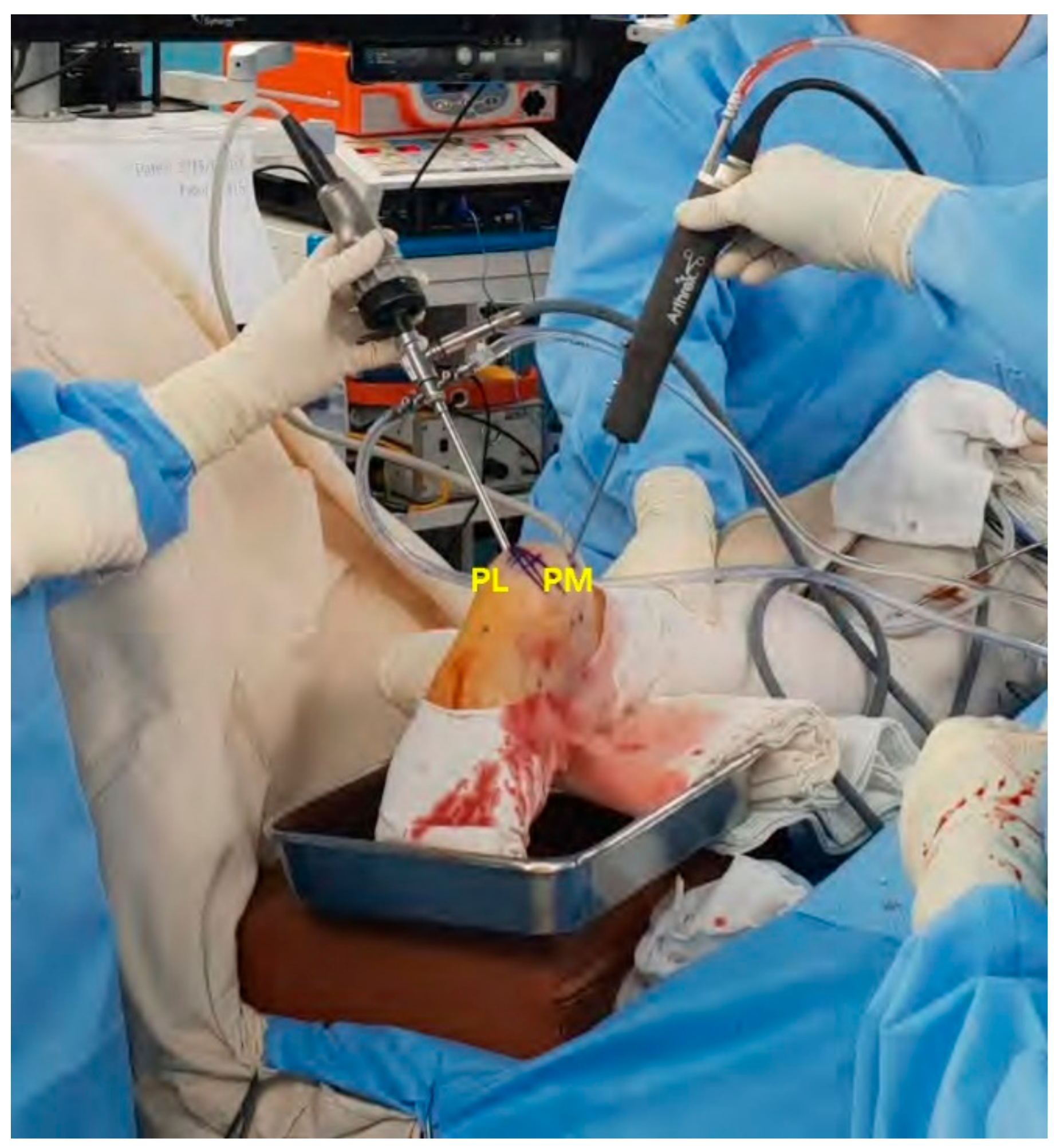 Medicina 57 00111 g006 Medicina 57 00111 g006