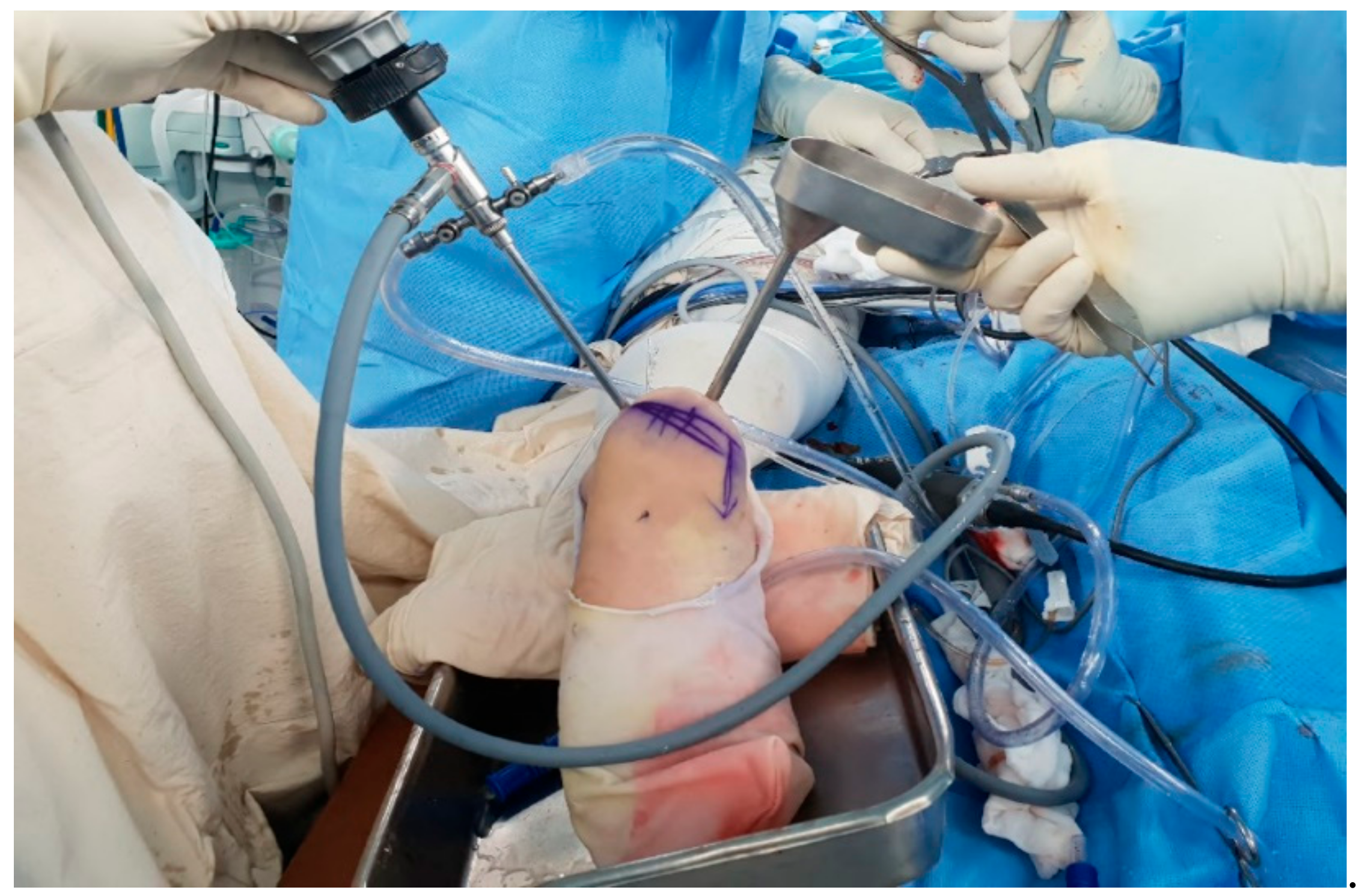 Medicina 57 00111 g008 Medicina 57 00111 g008