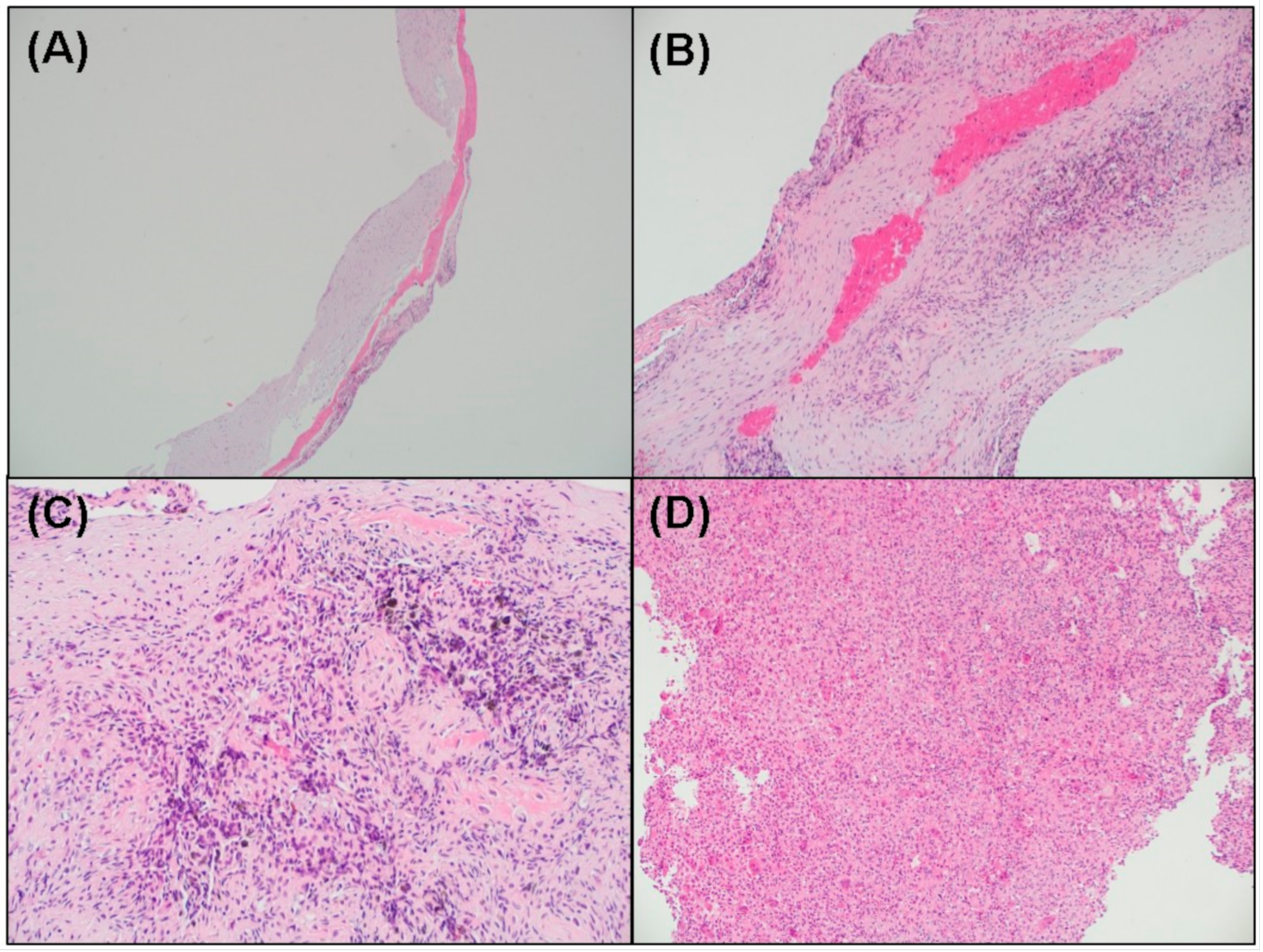 Medicina 57 00111 g009 Medicina 57 00111 g009