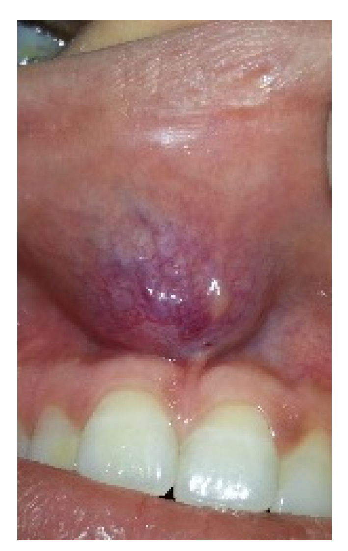 Medicina 57 00152 g001 Medicina 57 00152 g001