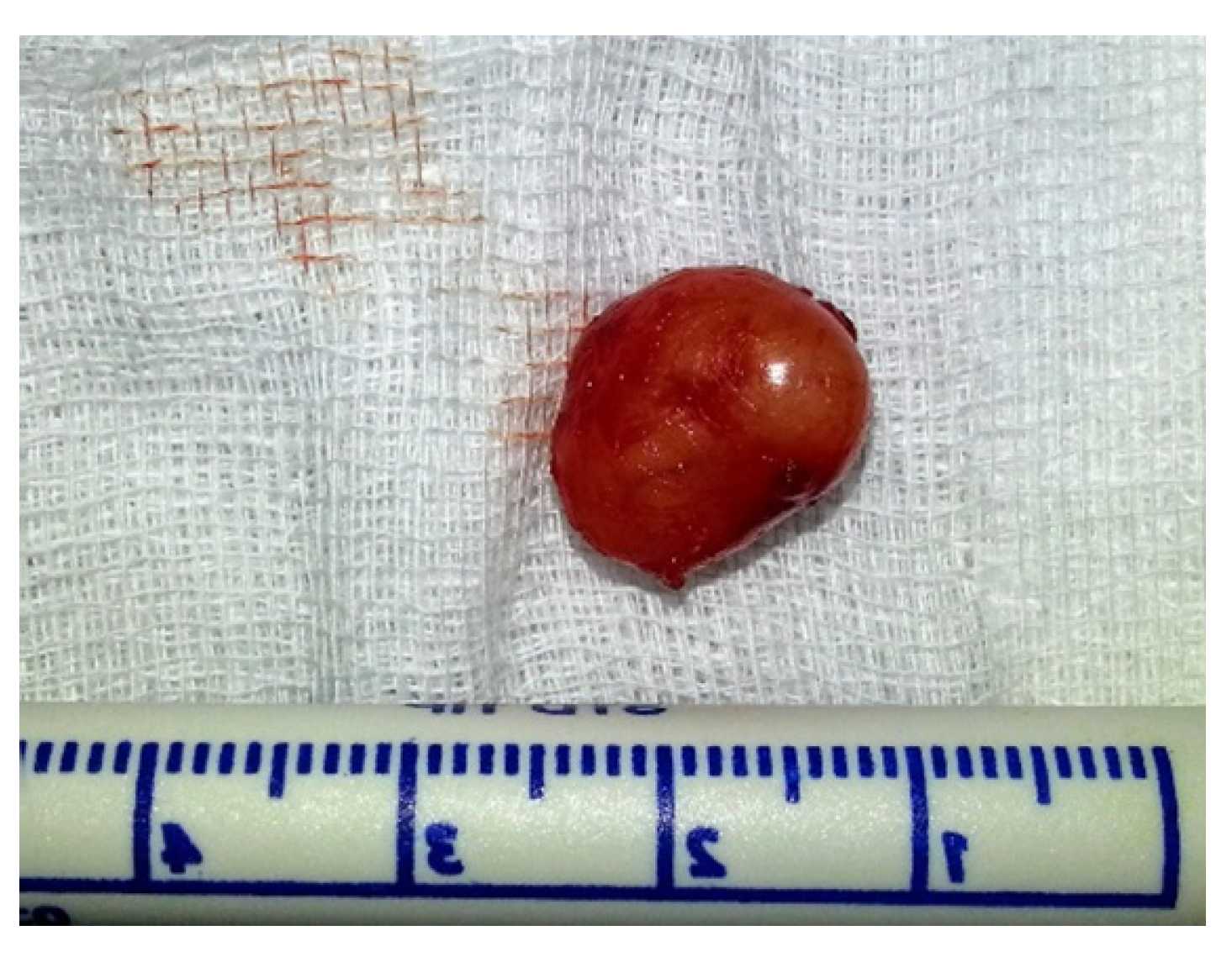 Medicina 57 00152 g002 Medicina 57 00152 g002