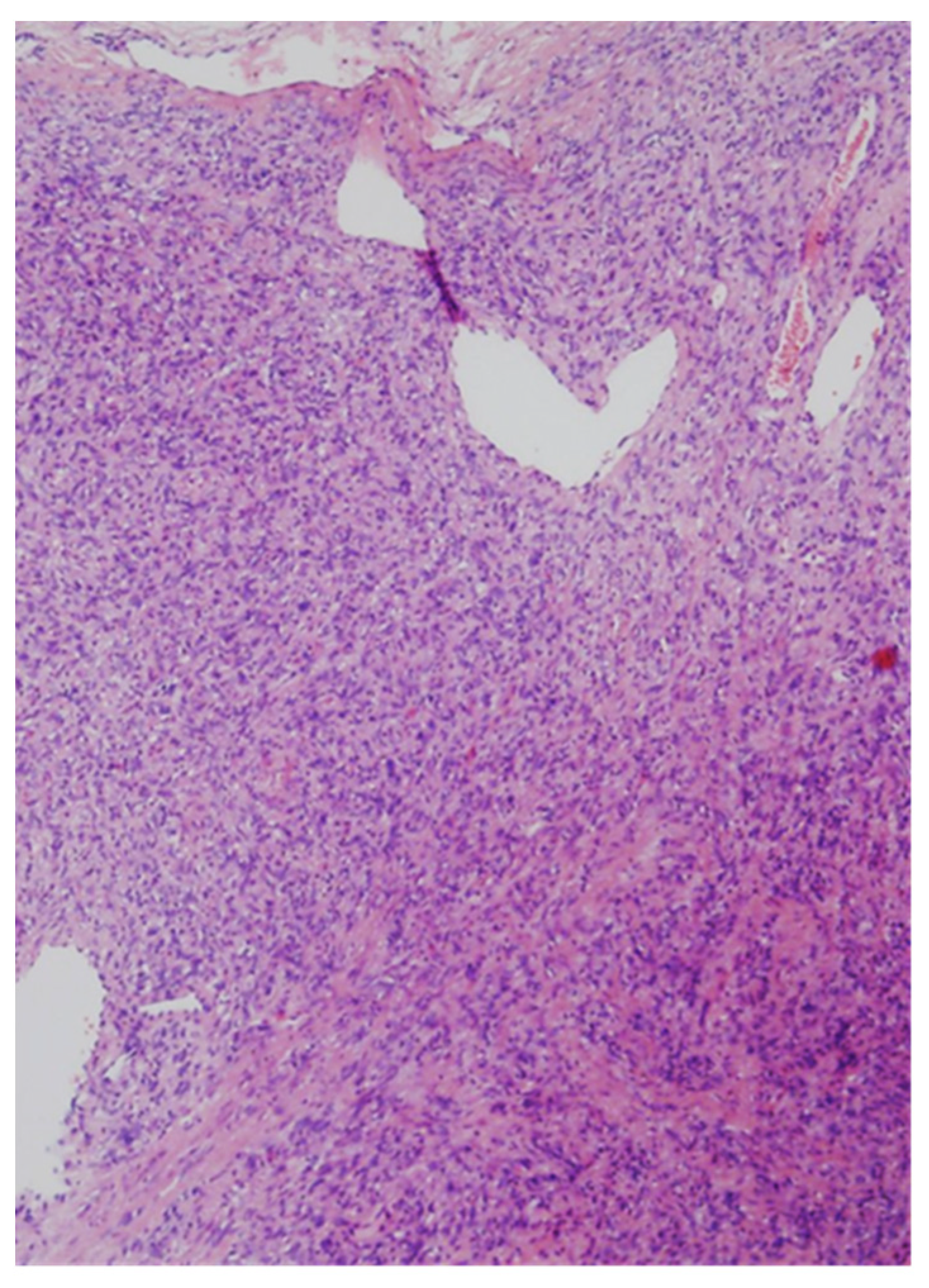 Medicina 57 00152 g003 Medicina 57 00152 g003