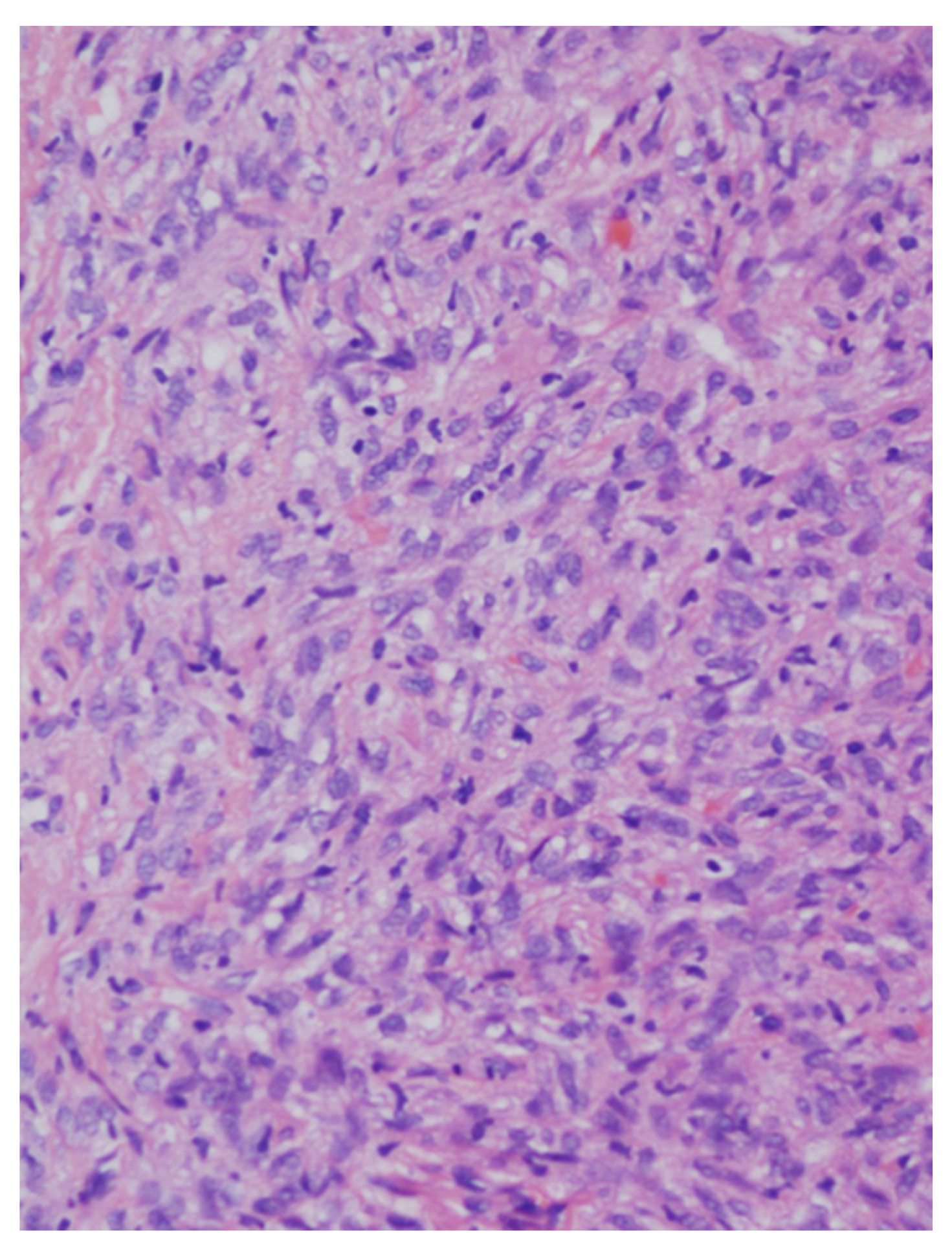 Medicina 57 00152 g004 Medicina 57 00152 g004