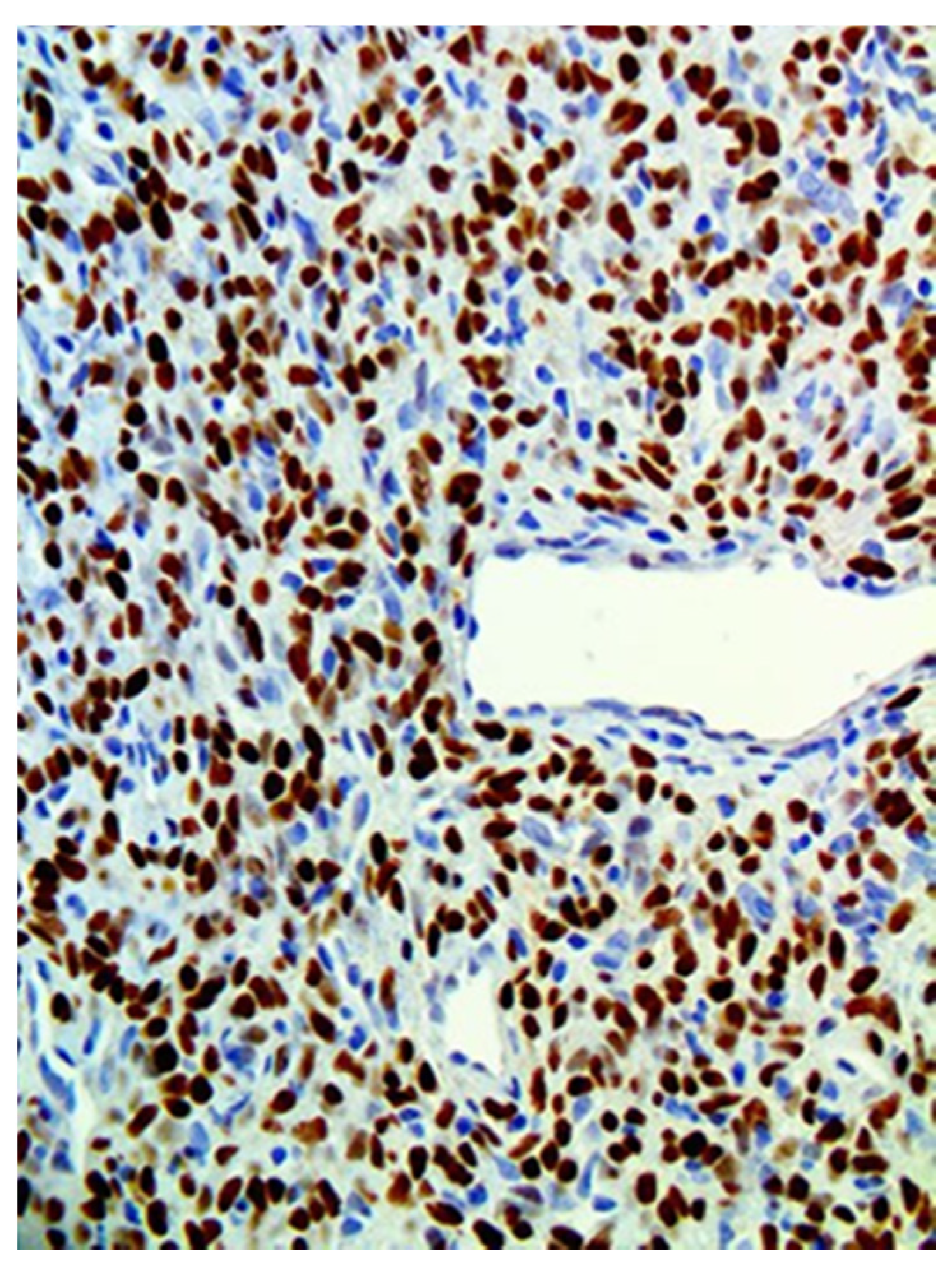 Medicina 57 00152 g007 Medicina 57 00152 g007