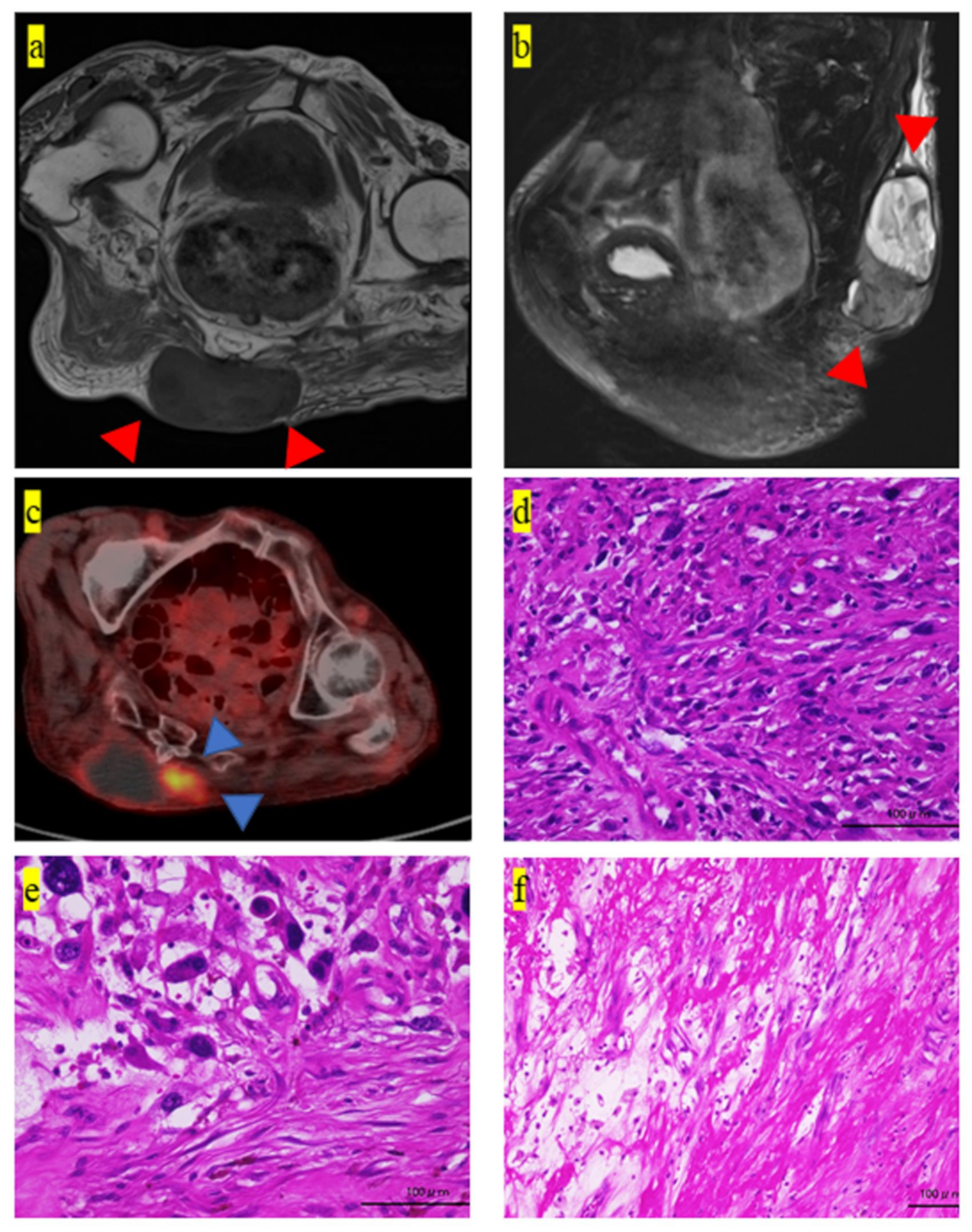 Medicina 57 00175 g001 Medicina 57 00175 g001