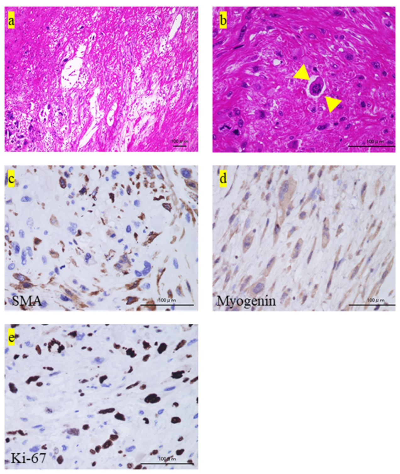 Medicina 57 00175 g002 Medicina 57 00175 g002