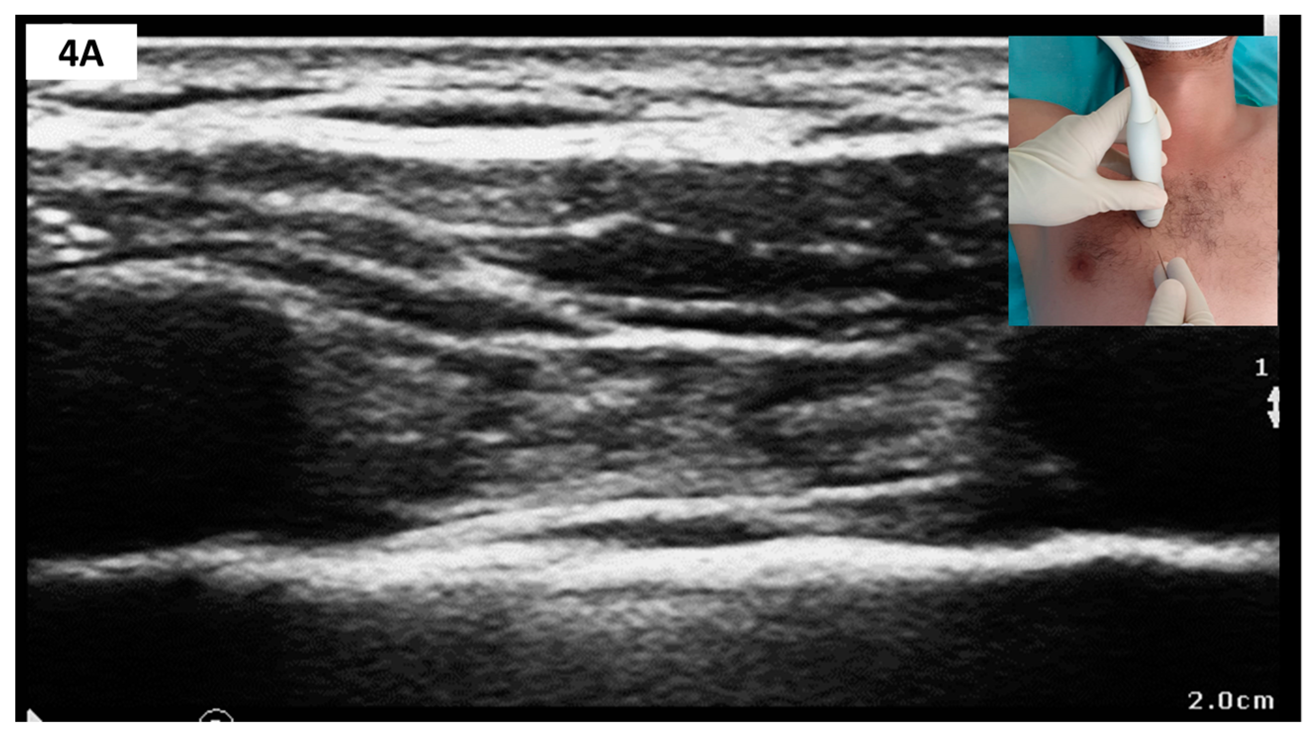 Medicina 57 00312 g004a Medicina 57 00312 g004a