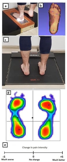 Medicina | Free Full-Text | The Influence of Short-Term Kinesiology Taping  on Foot Anthropometry and Pain in Patients Suffering from Hallux Valgus |  HTML