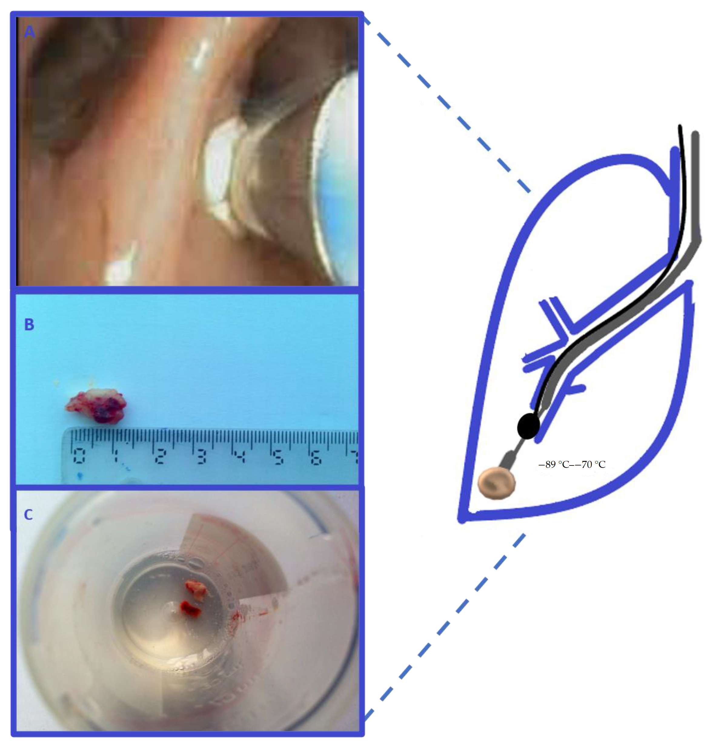 Medicina 57 00393 g002 Medicina 57 00393 g002