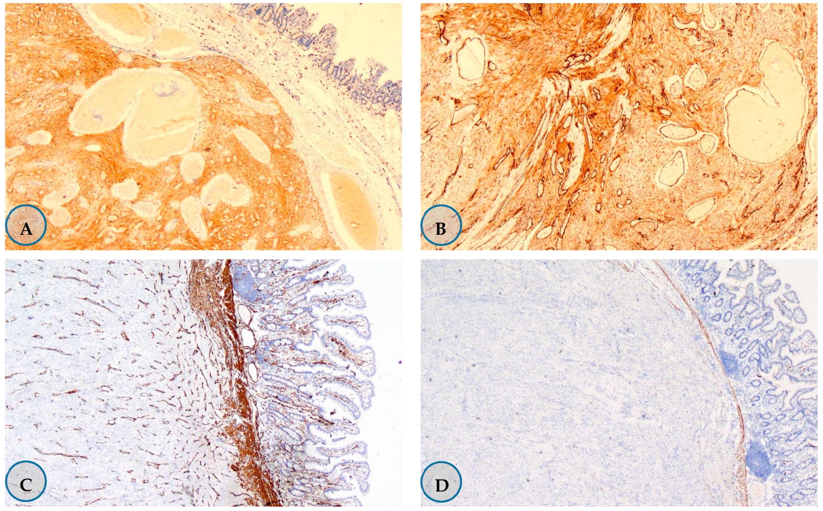 Medicina 57 00494 g001a Medicina 57 00494 g001a