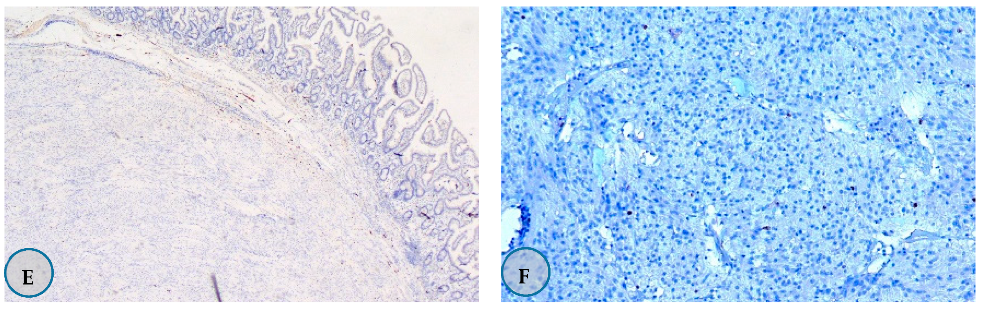 Medicina 57 00494 g001b Medicina 57 00494 g001b