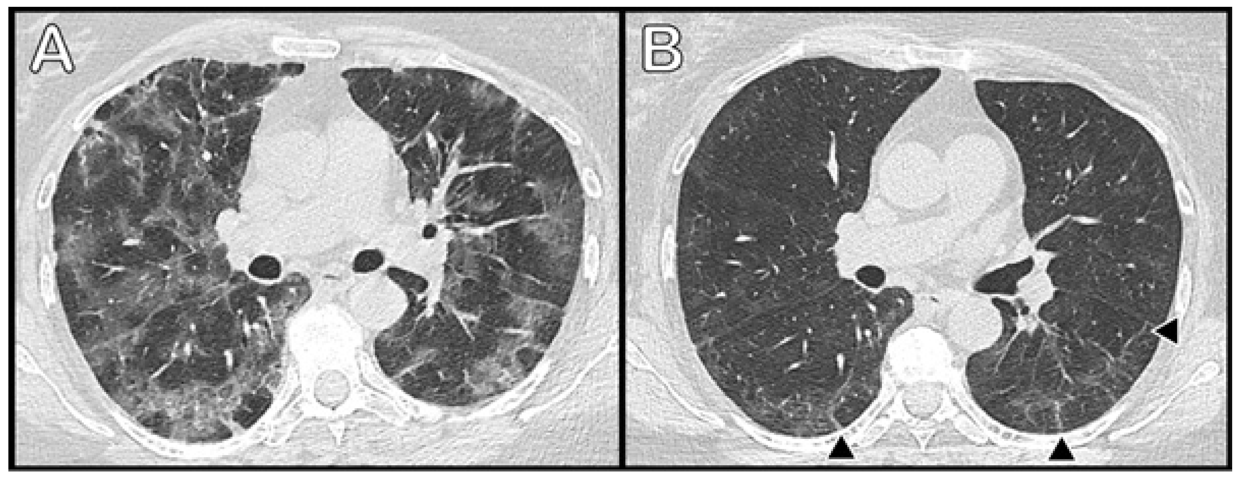 Medicina 57 00568 g002 Medicina 57 00568 g002