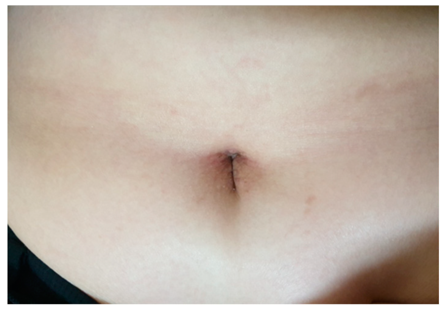 I was wondering if a scar like this could be turned into a belly button?  (Photo)