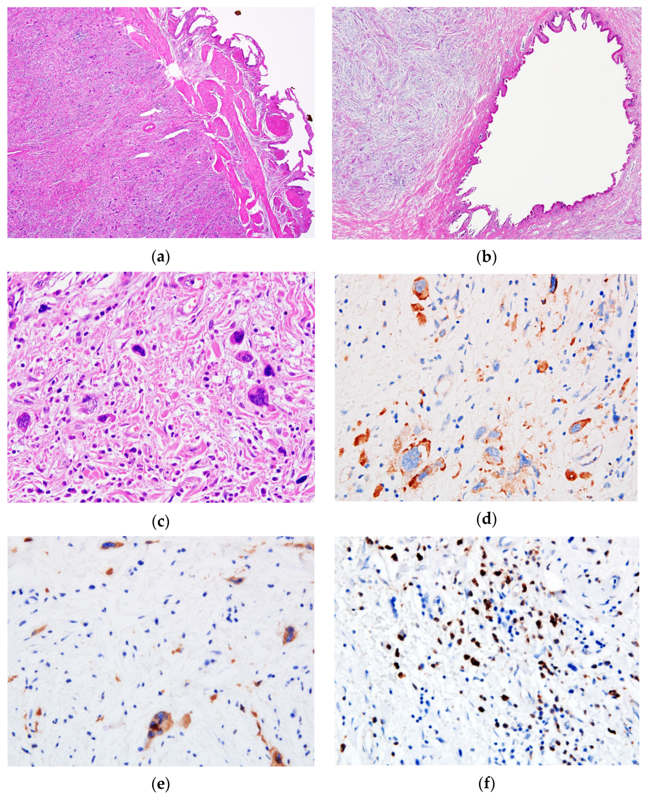 Medicina 57 00824 g002