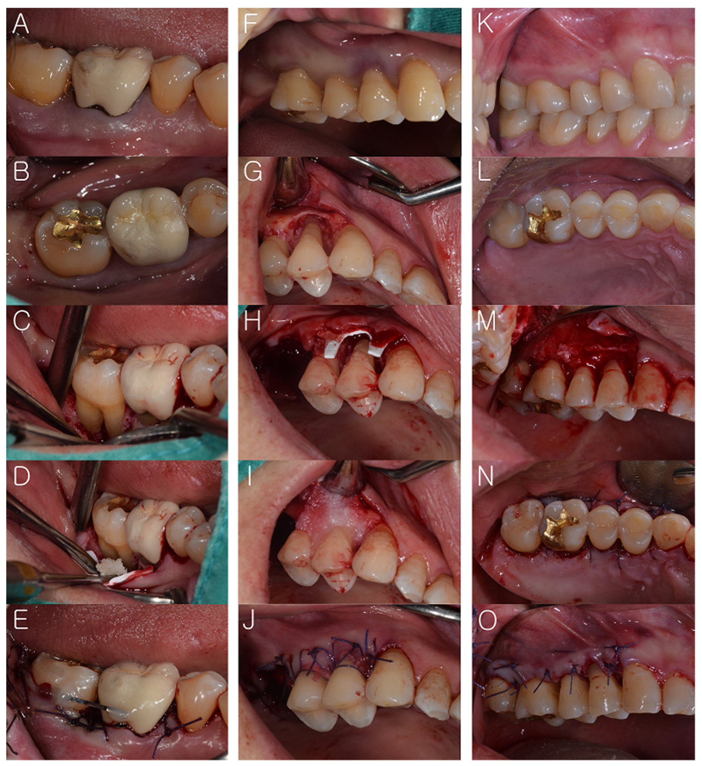 Medicina 57 00869 g002