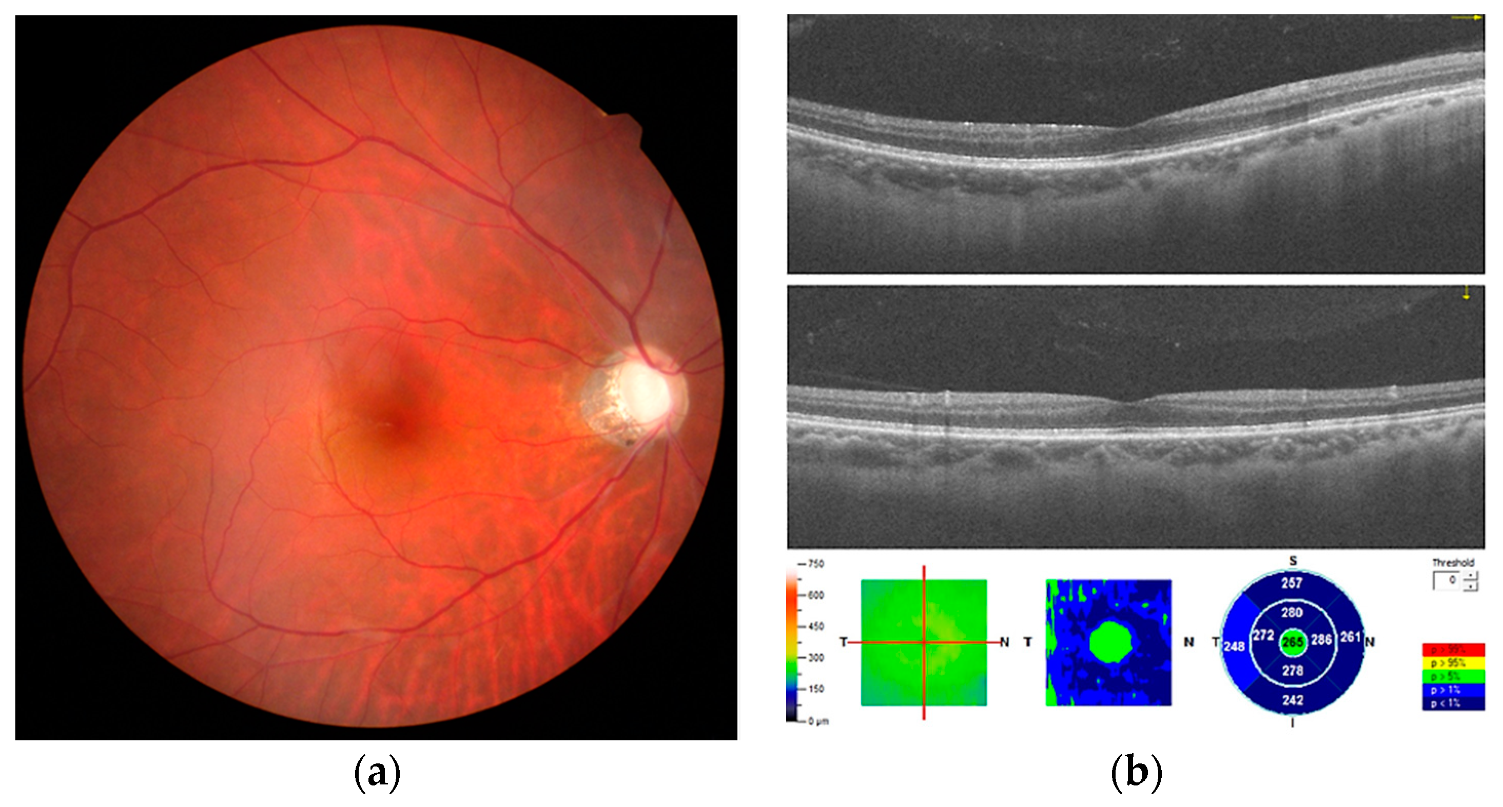Medicina 57 00896 g002
