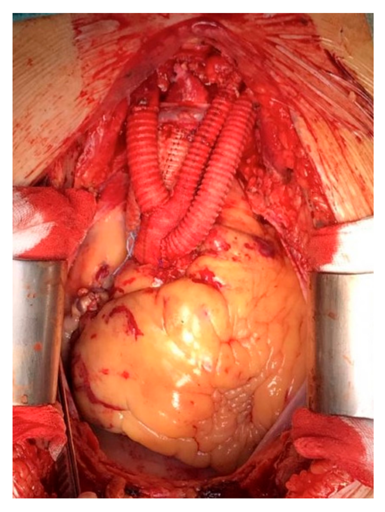 Medicina 57 00909 g003 Medicina 57 00909 g003