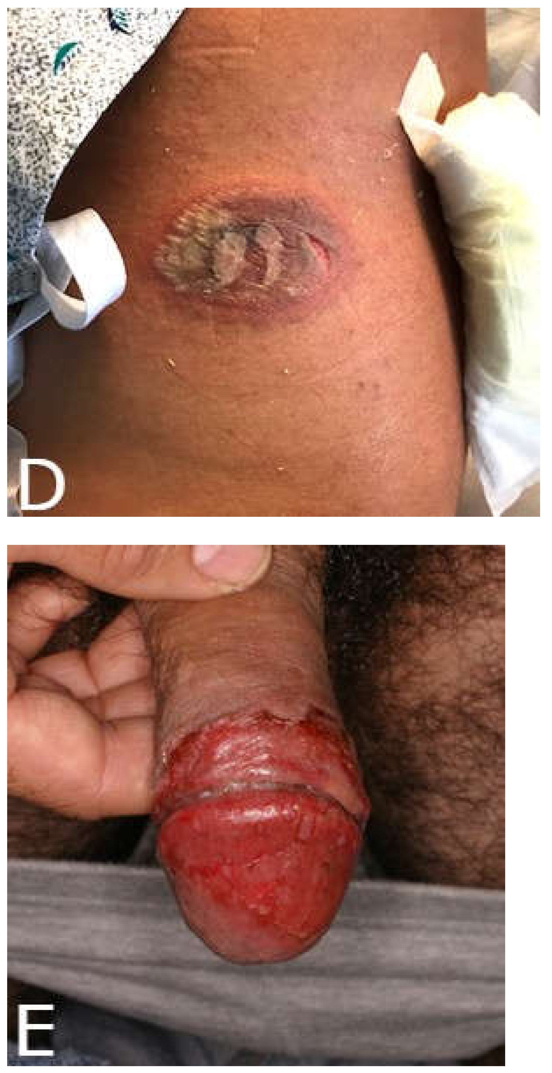 Medicina 57 00925 g001b Medicina 57 00925 g001b