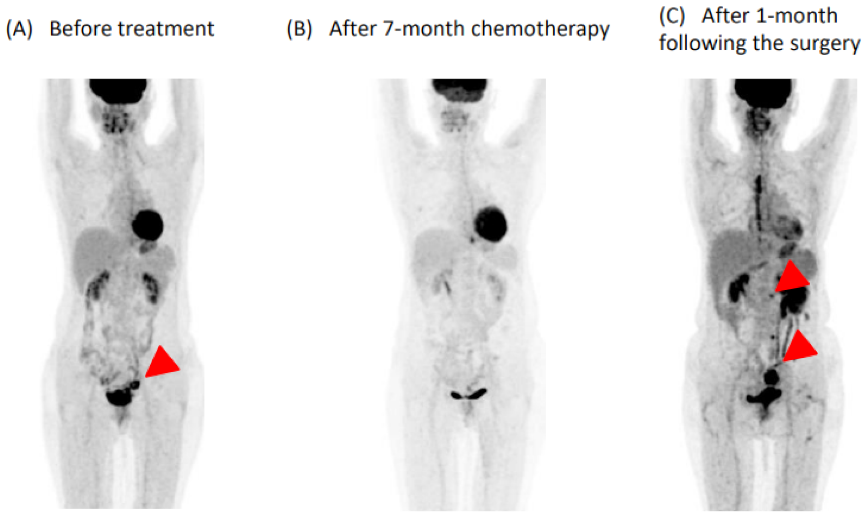 Medicina 57 00998 g001