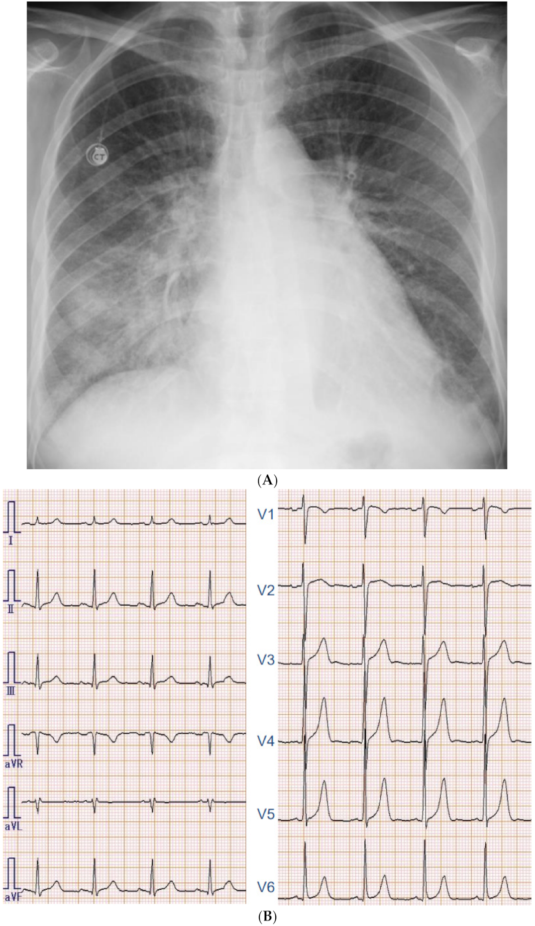 Medicina 57 00998 g002a