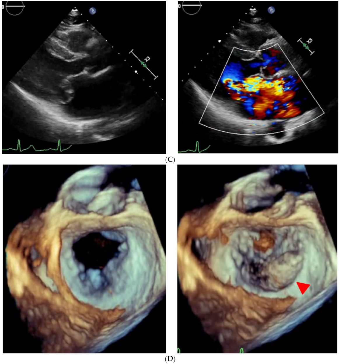 Medicina 57 00998 g002b