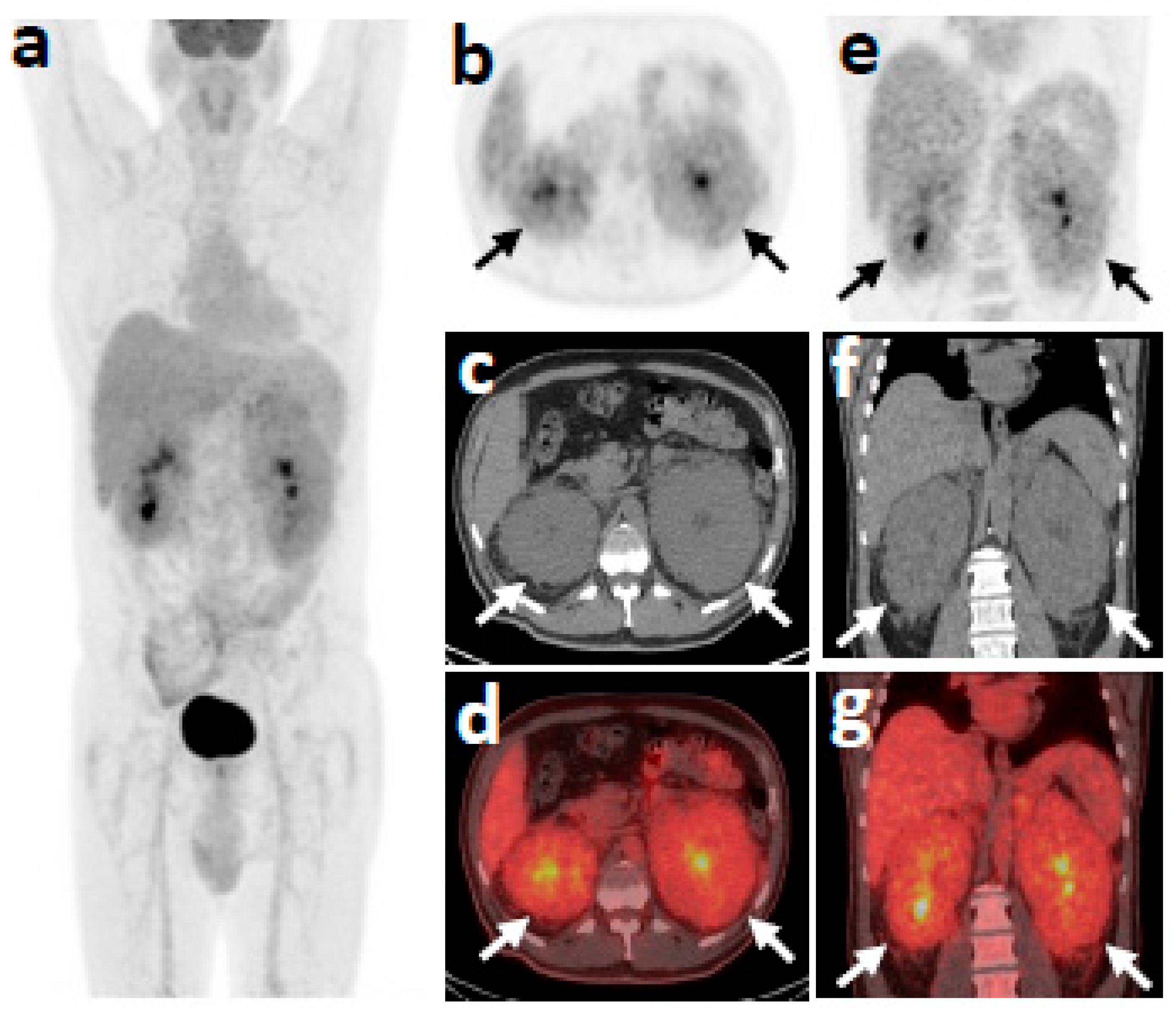 Medicina | Free Full-Text | Diagnosing a Patient with Erdheim 