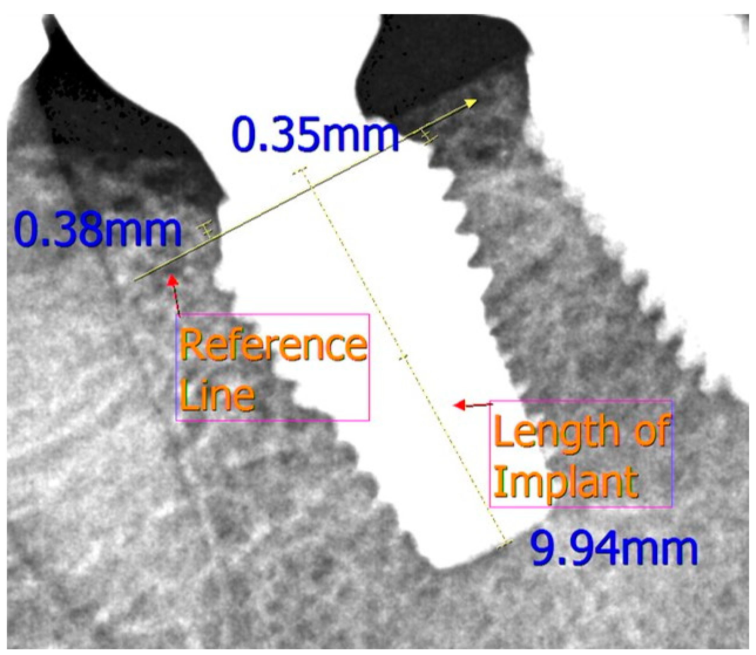 Medicina 57 01009 g002 Medicina 57 01009 g002
