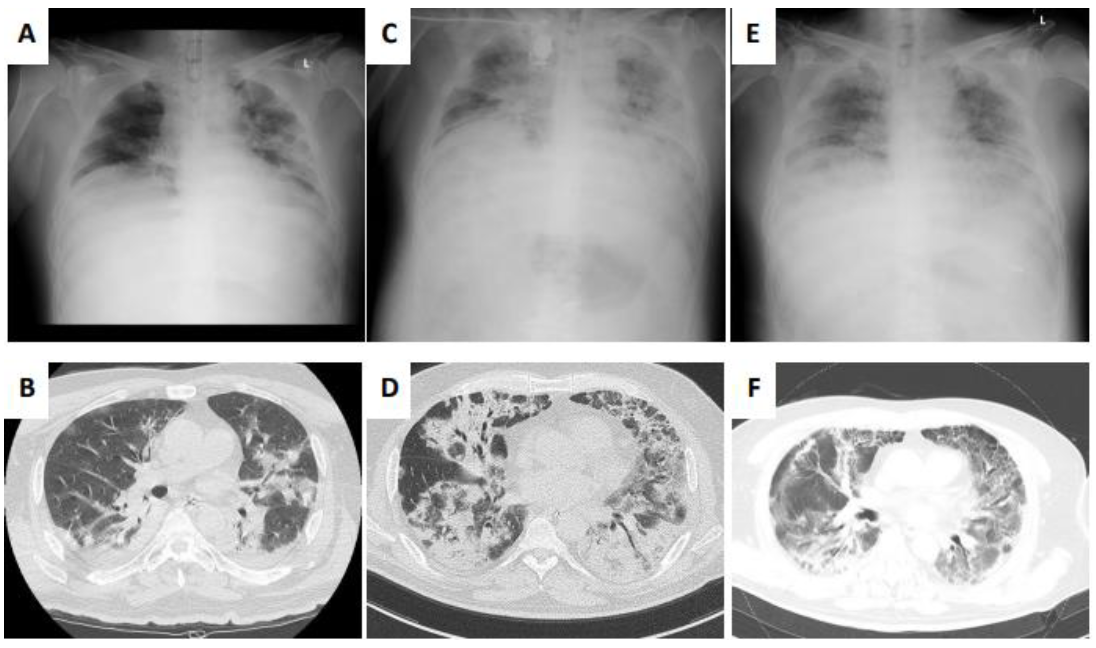 Medicina 57 01013 g001