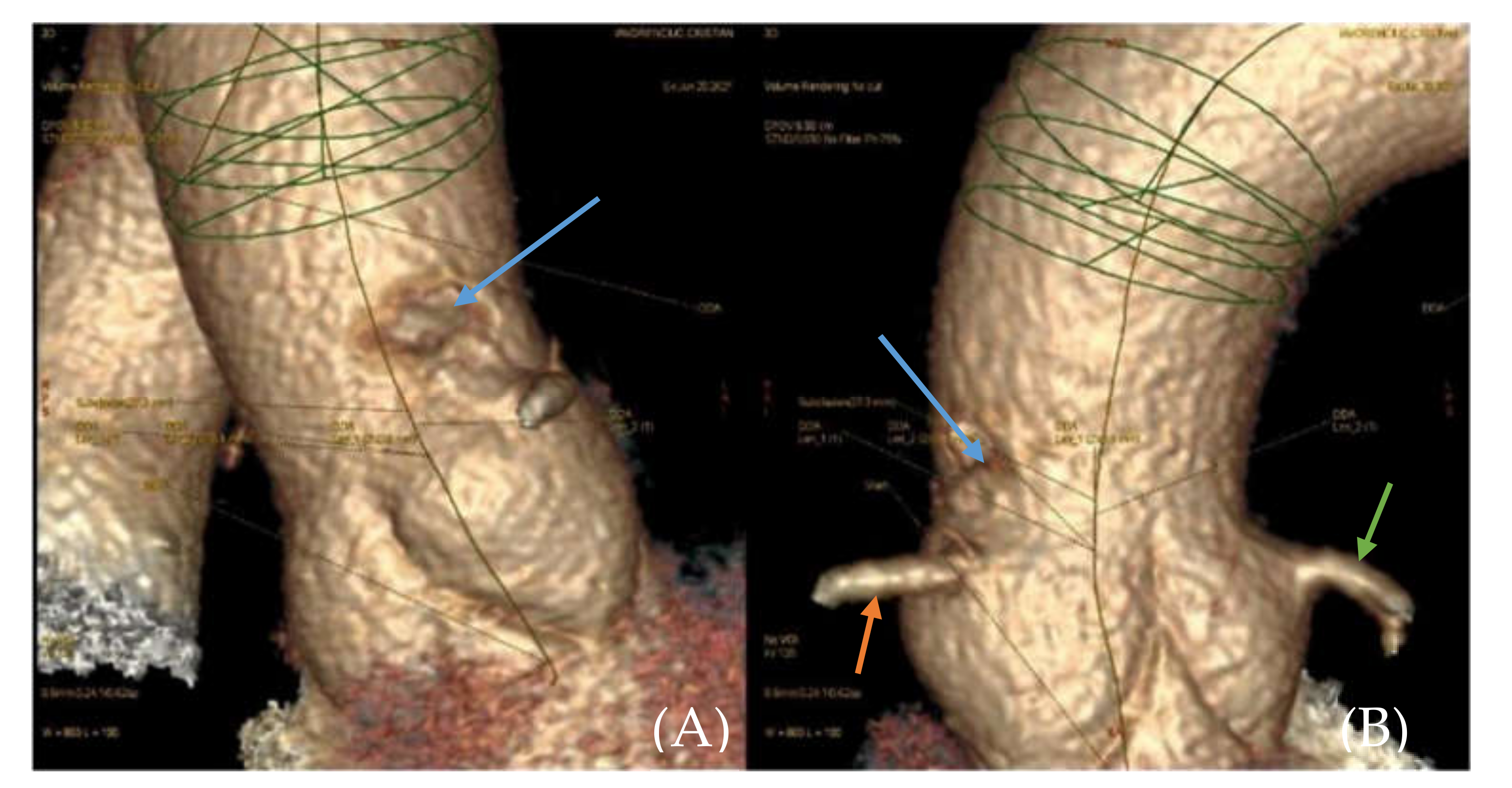 Medicina 57 01176 g002 Medicina 57 01176 g002