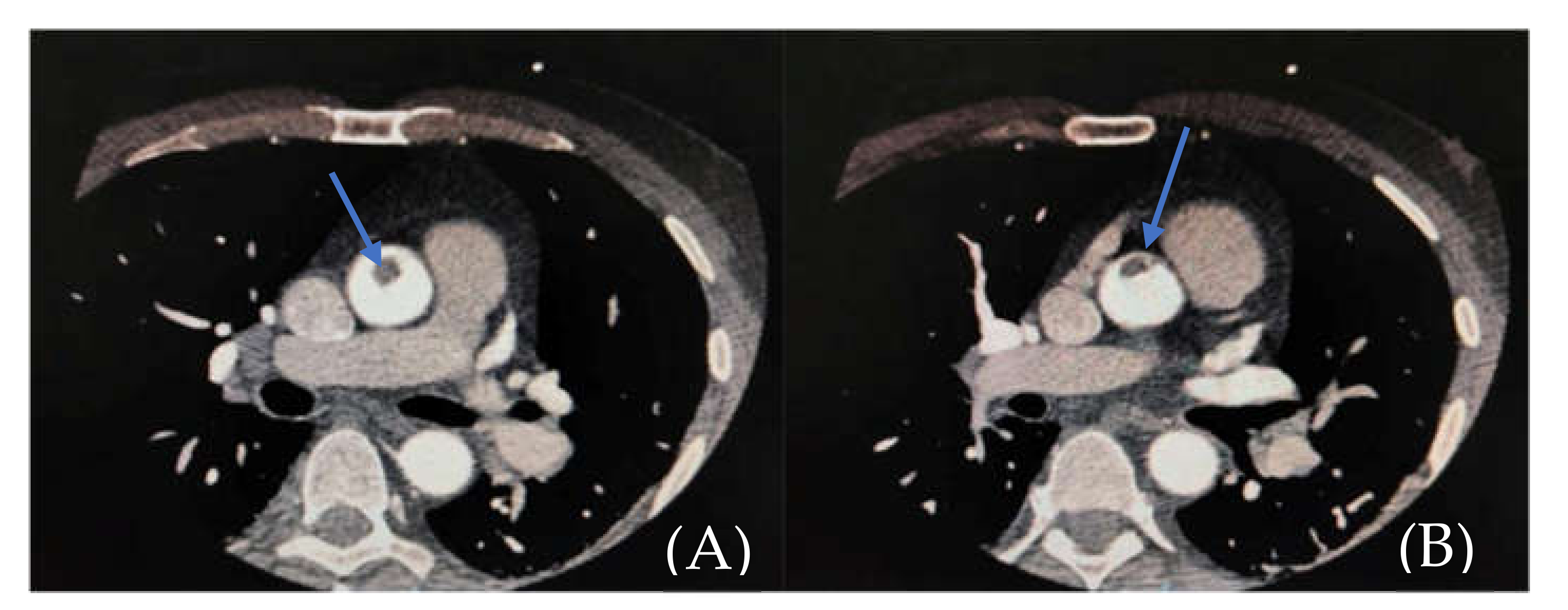 Medicina 57 01176 g003 Medicina 57 01176 g003