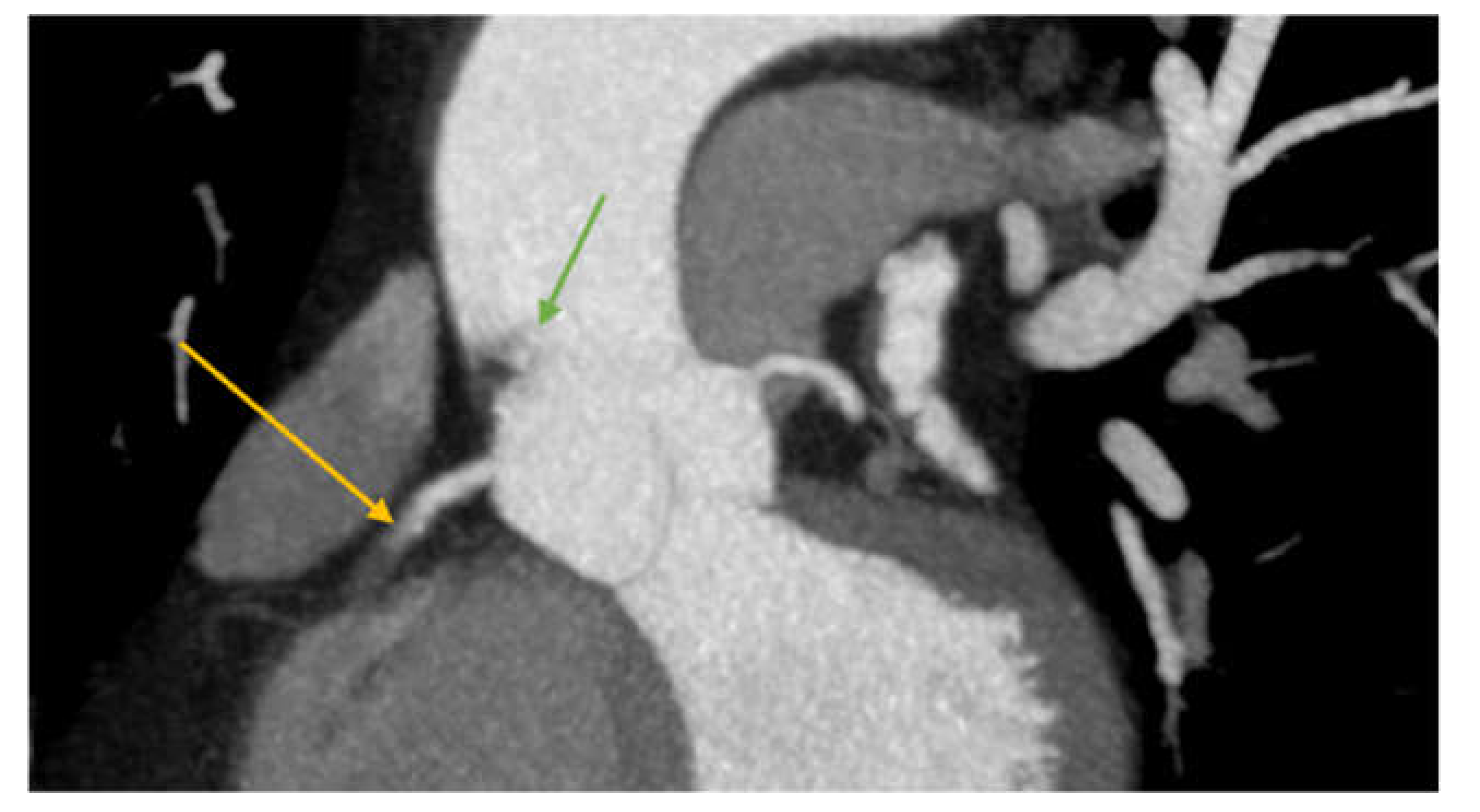 Medicina 57 01176 g005 Medicina 57 01176 g005