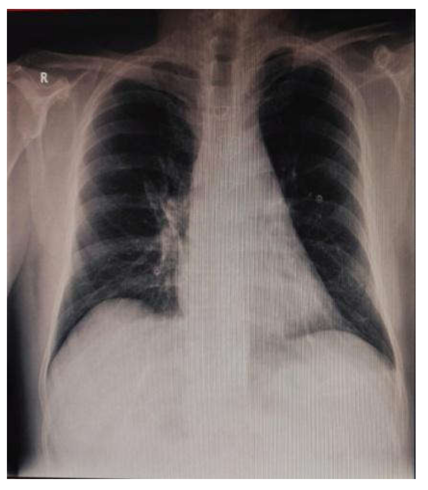 Medicina 57 01176 g007 Medicina 57 01176 g007