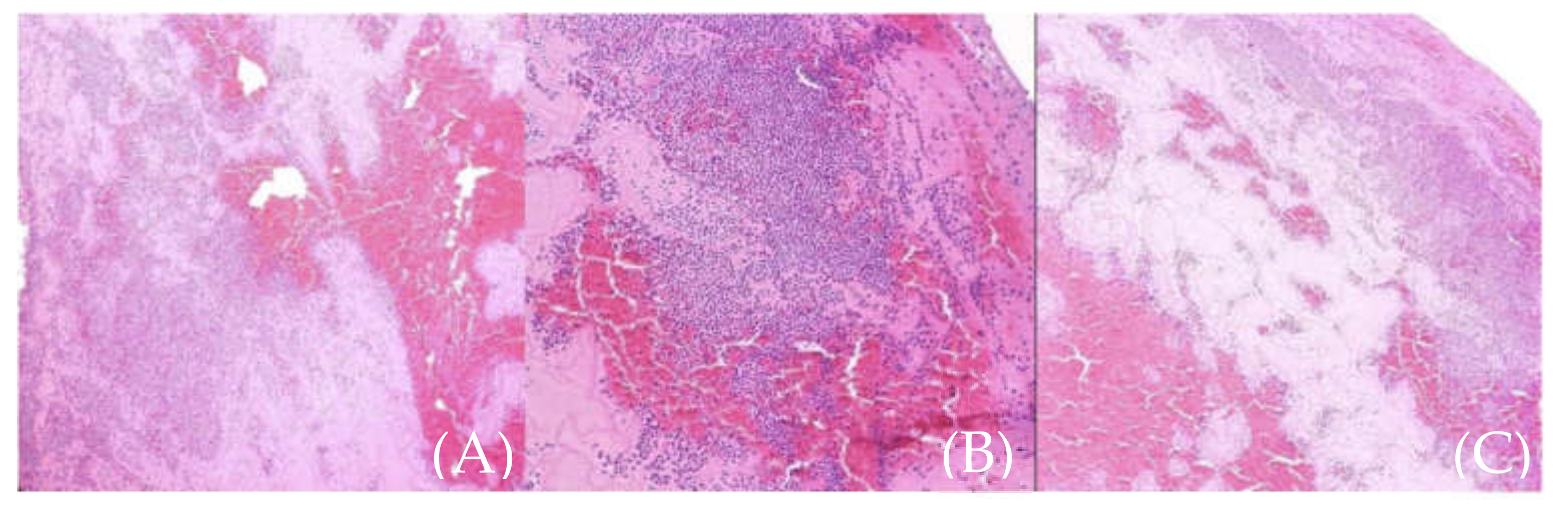 Medicina 57 01176 g008 Medicina 57 01176 g008