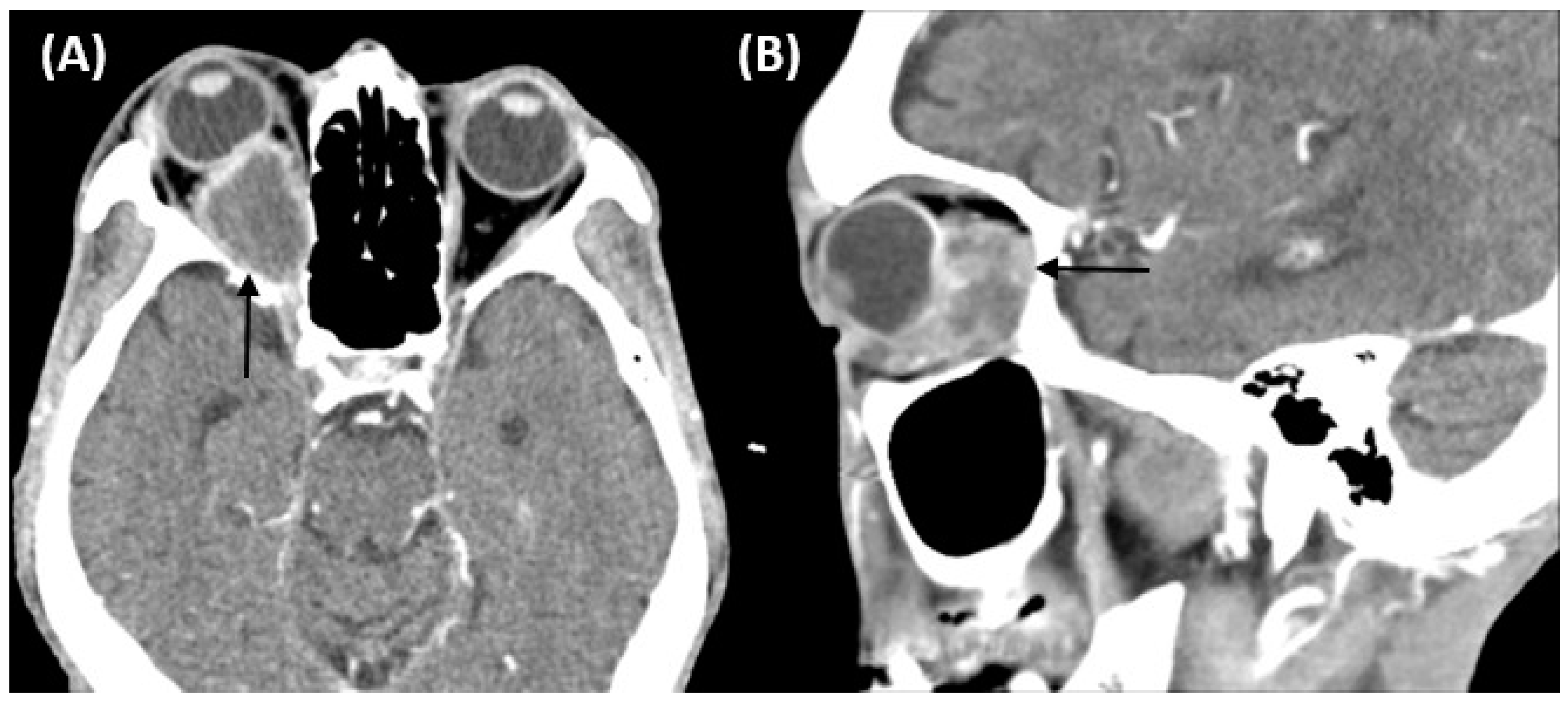 Medicina 57 01238 g002