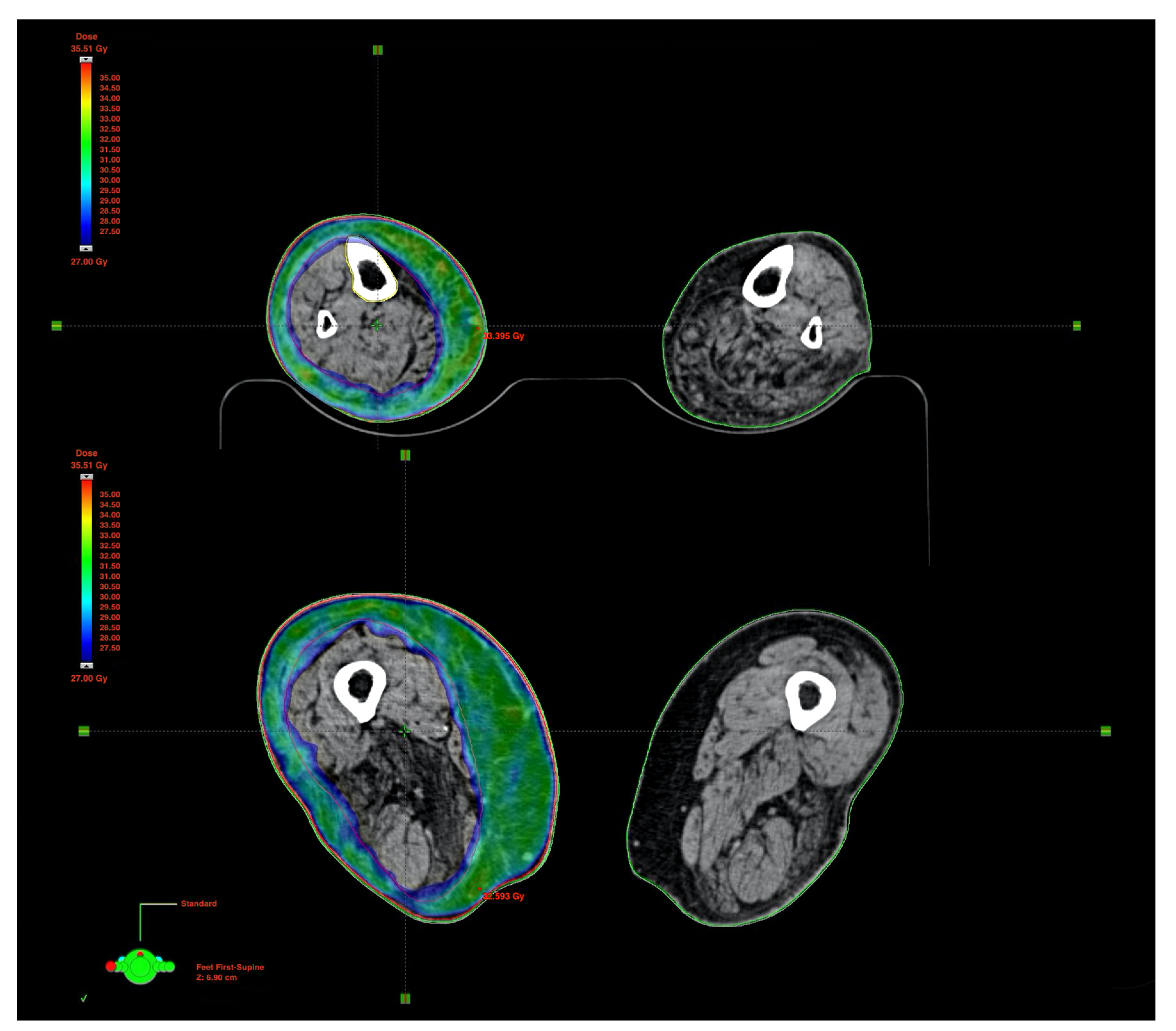 Medicina 57 01379 g003 Medicina 57 01379 g003