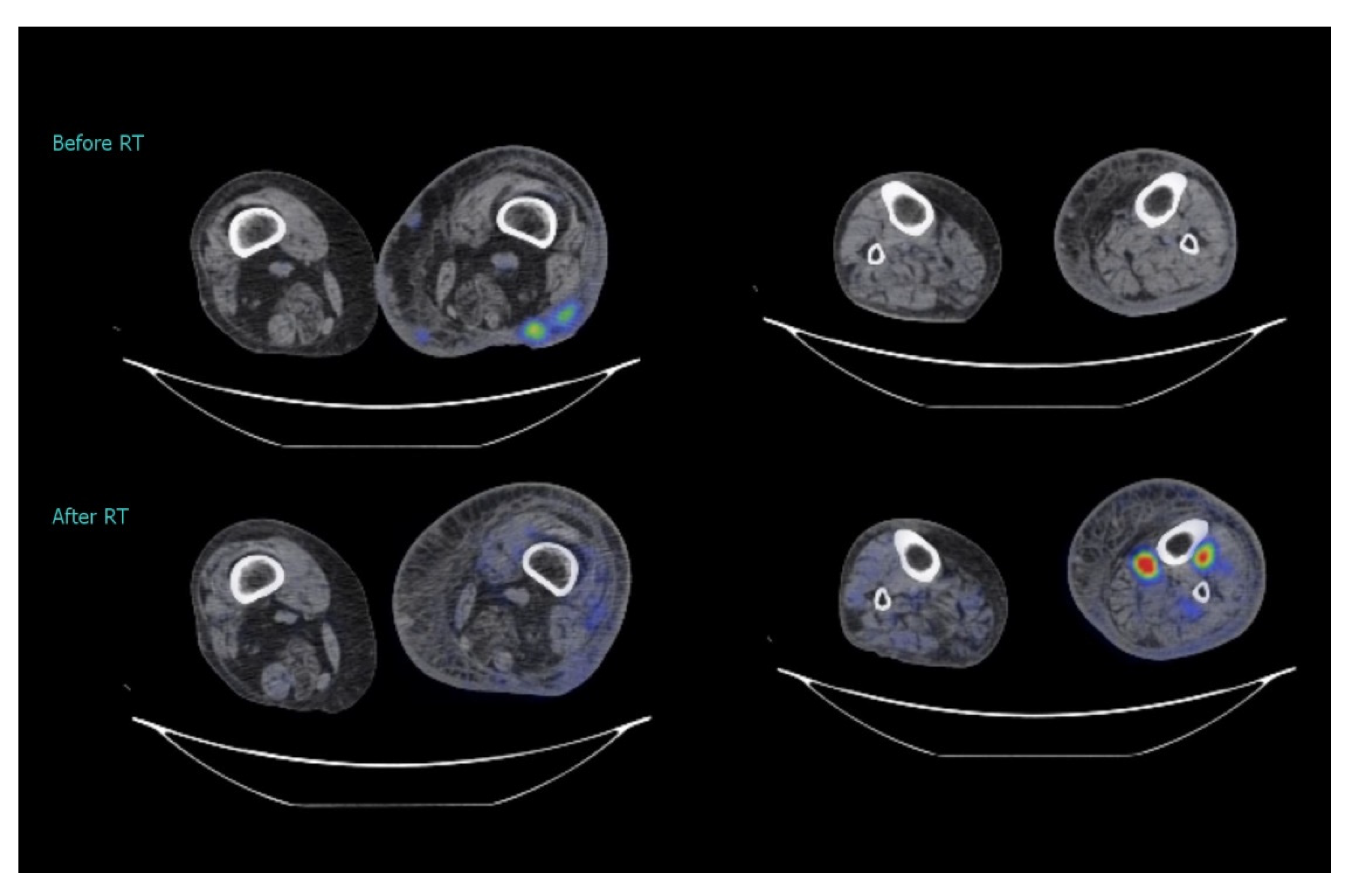 Medicina 57 01379 g005 Medicina 57 01379 g005