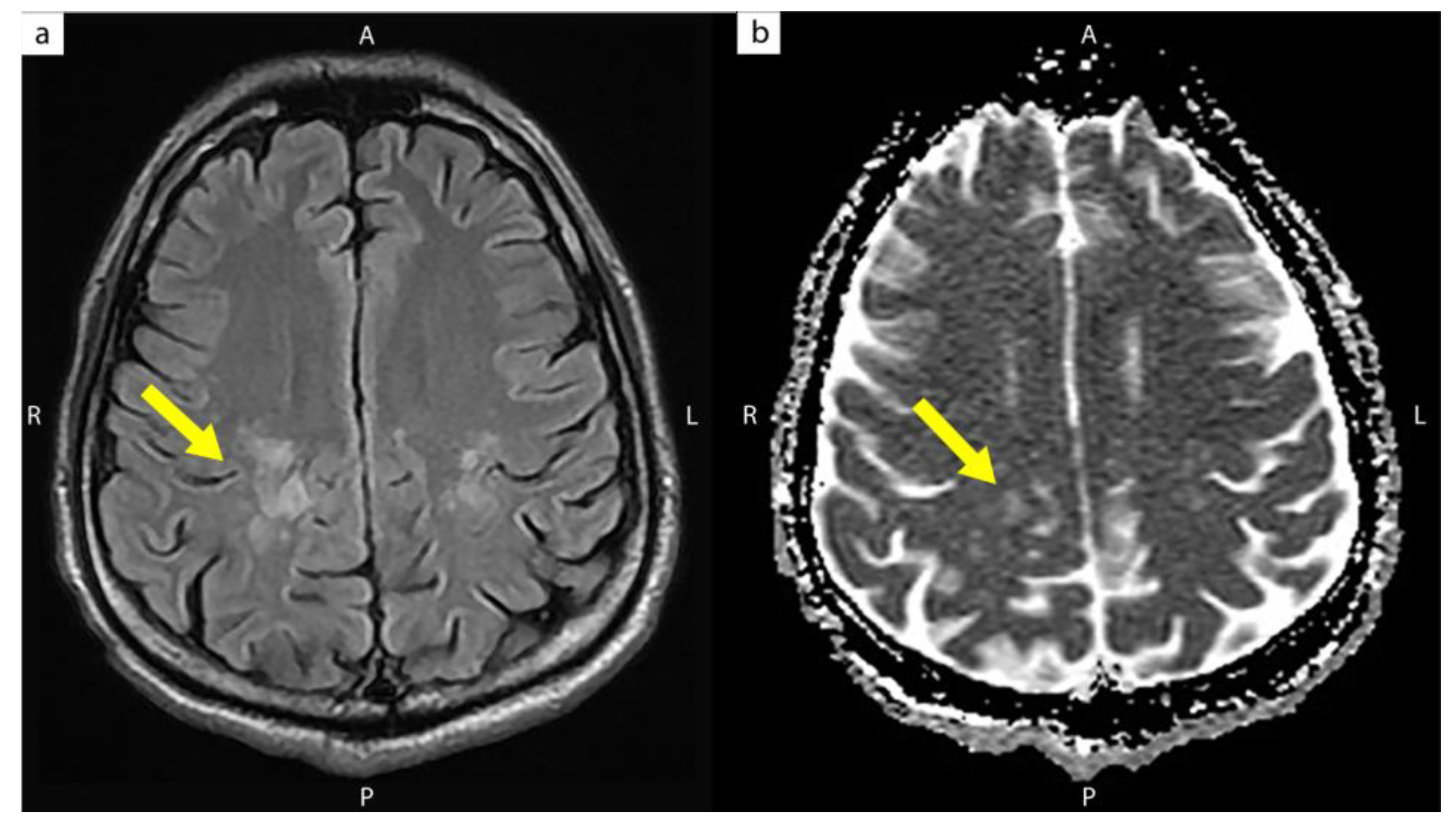 Medicina 58 00110 g002 Medicina 58 00110 g002