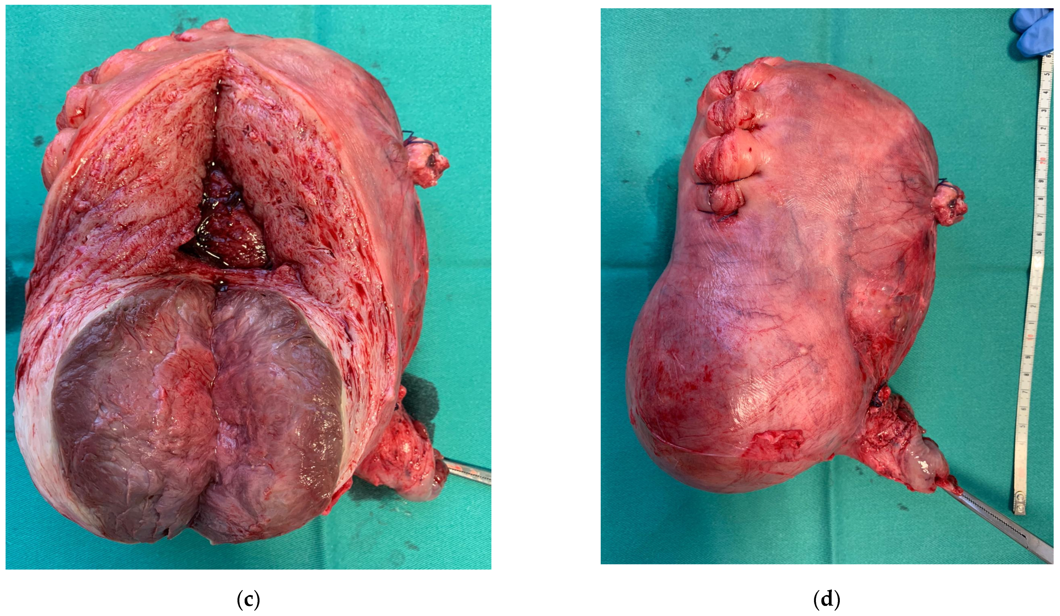 Medicina 58 00111 g001b