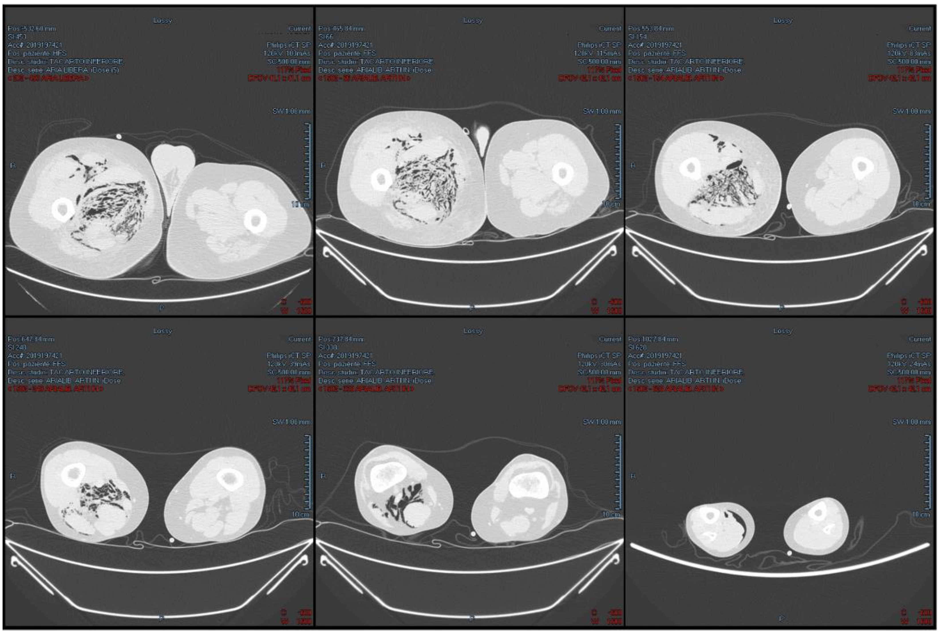 Medicina 58 00131 g002 Medicina 58 00131 g002