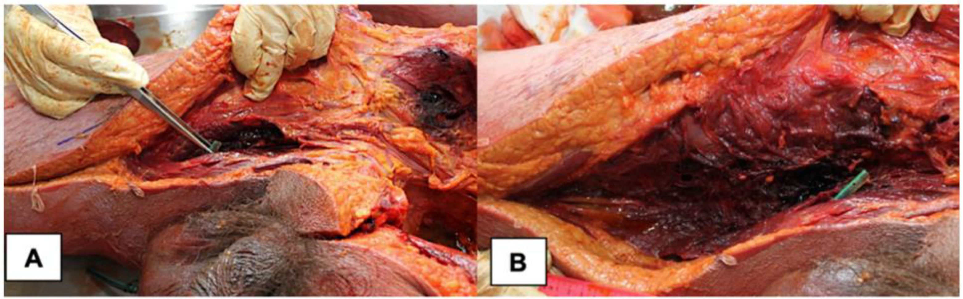 Medicina 58 00131 g003 Medicina 58 00131 g003