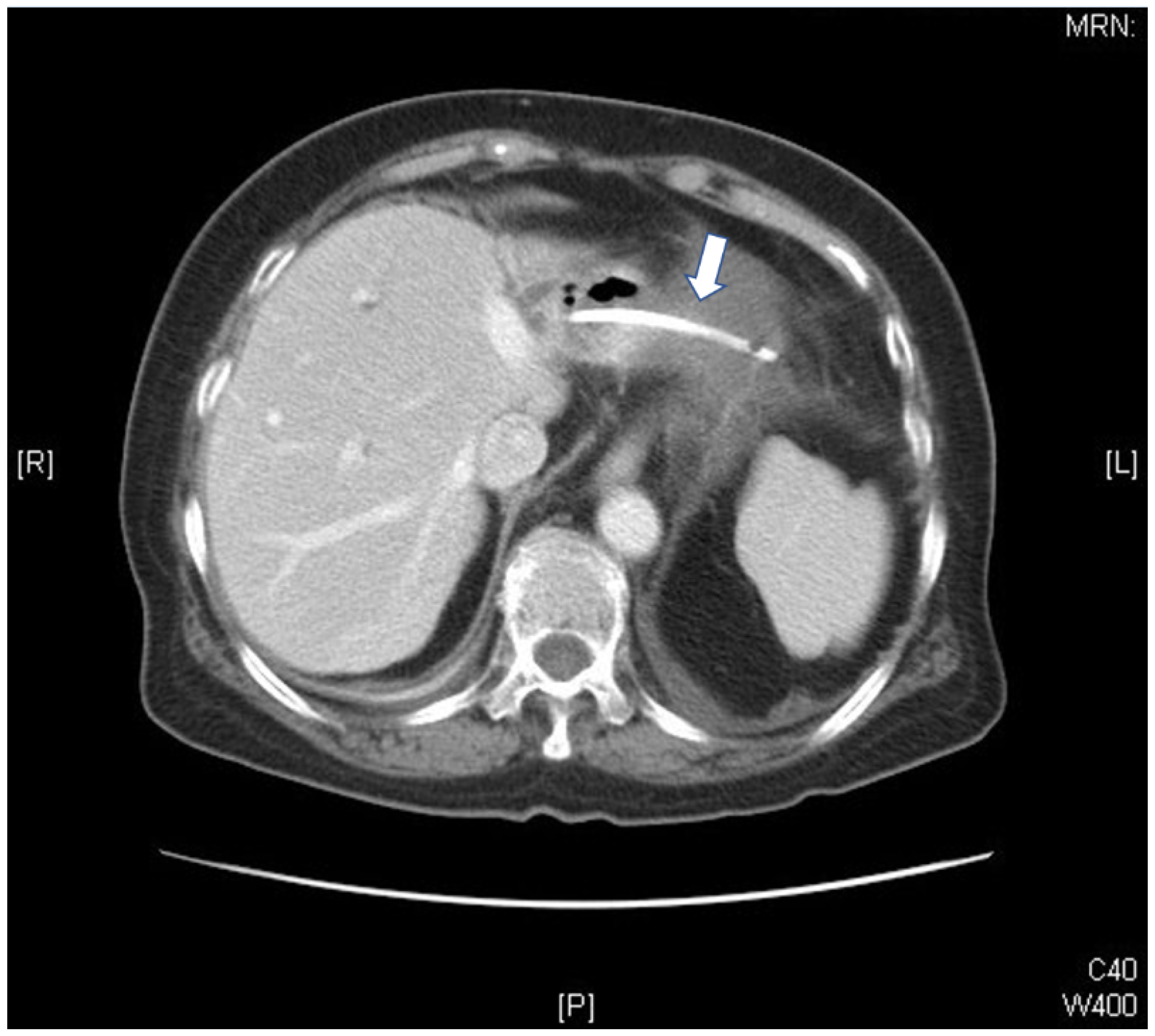 Medicina 58 00132 g001 Medicina 58 00132 g001
