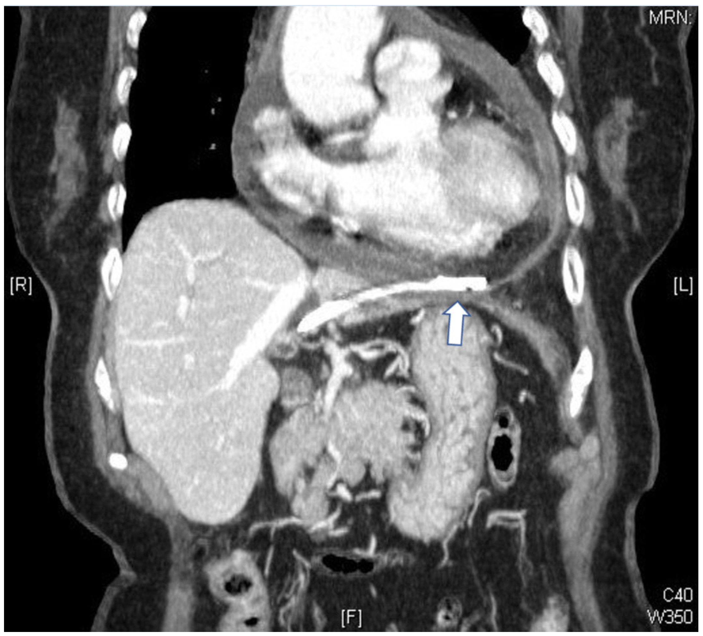 Medicina 58 00132 g002 Medicina 58 00132 g002