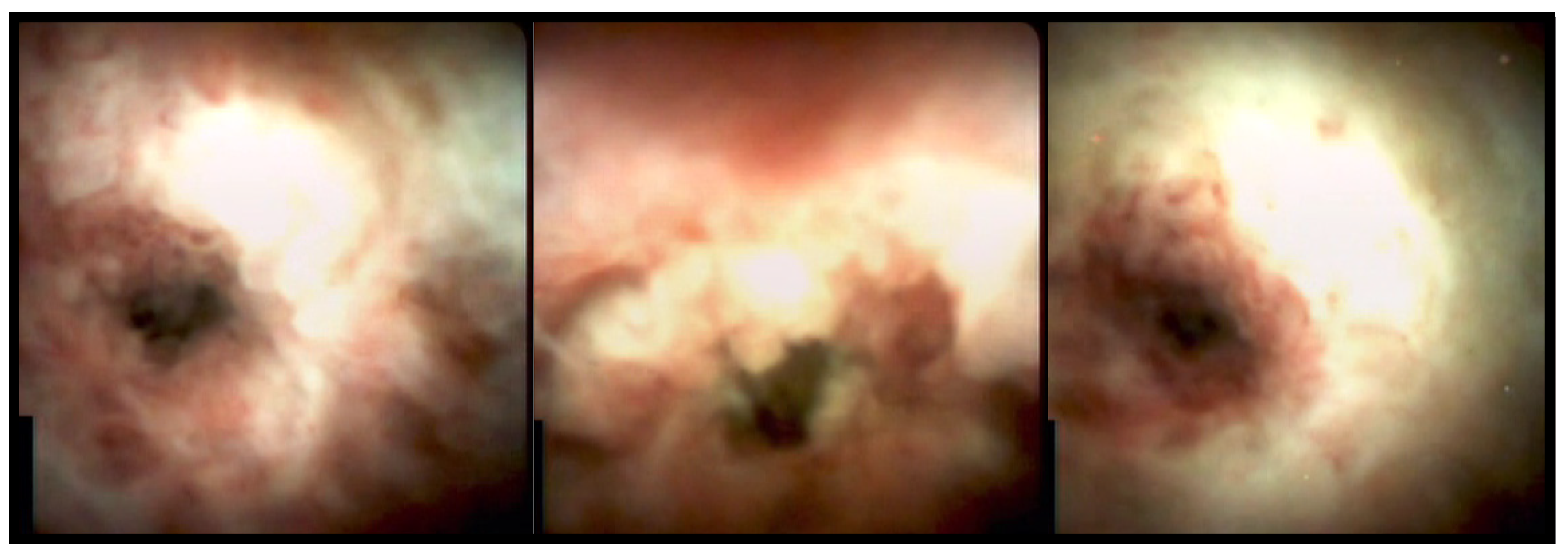 Medicina 58 00135 g002 Medicina 58 00135 g002