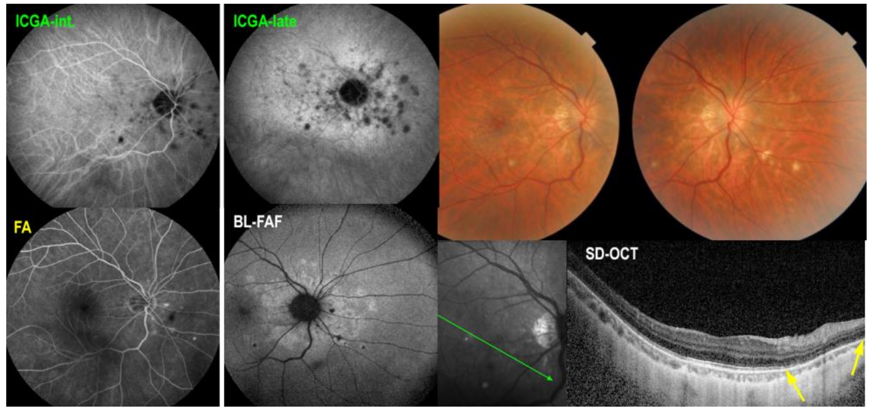 Medicina 58 00165 g003