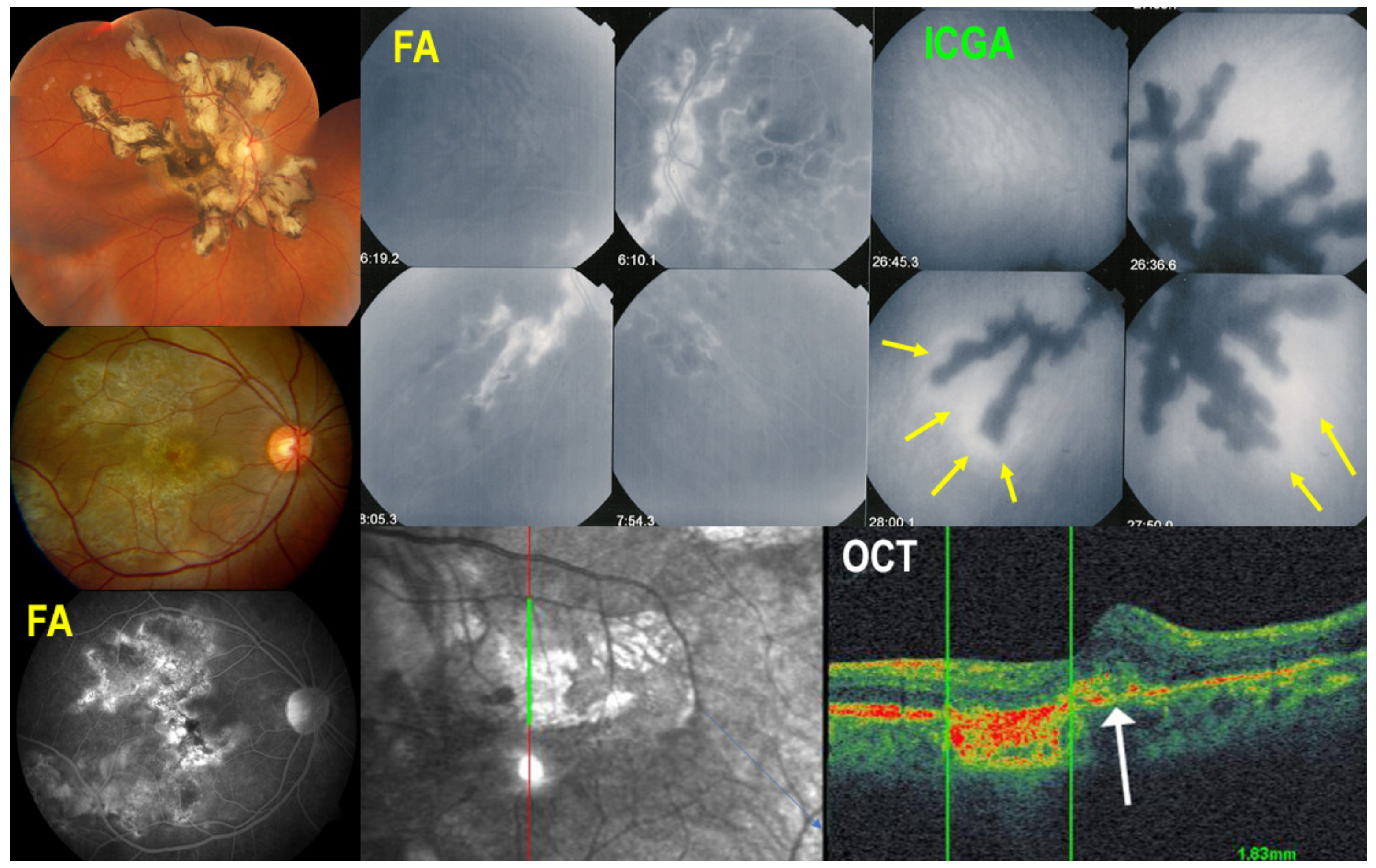Medicina 58 00165 g004